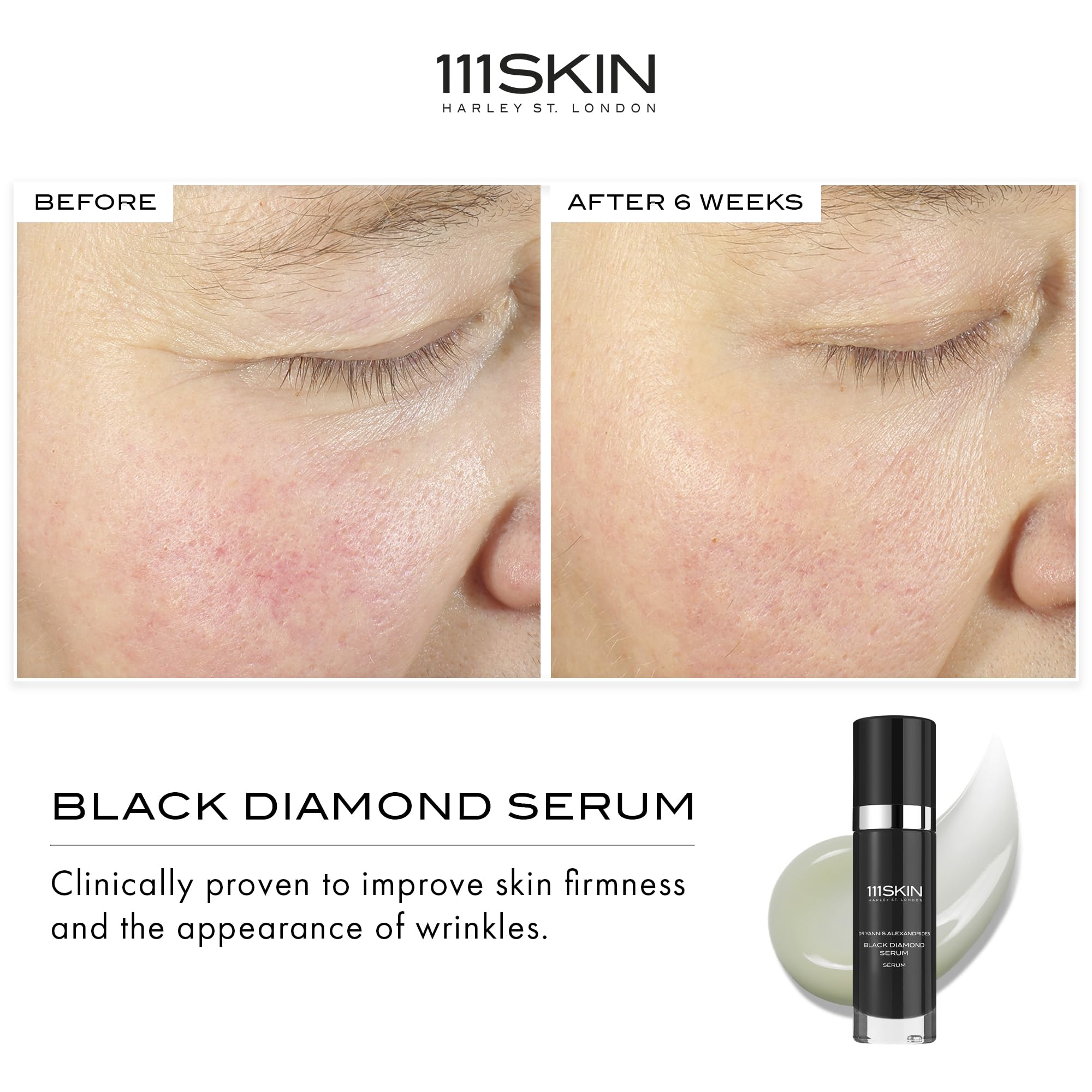 111SKIN Black Diamond Serum – Lightweight Firming Serum with NAC Y2