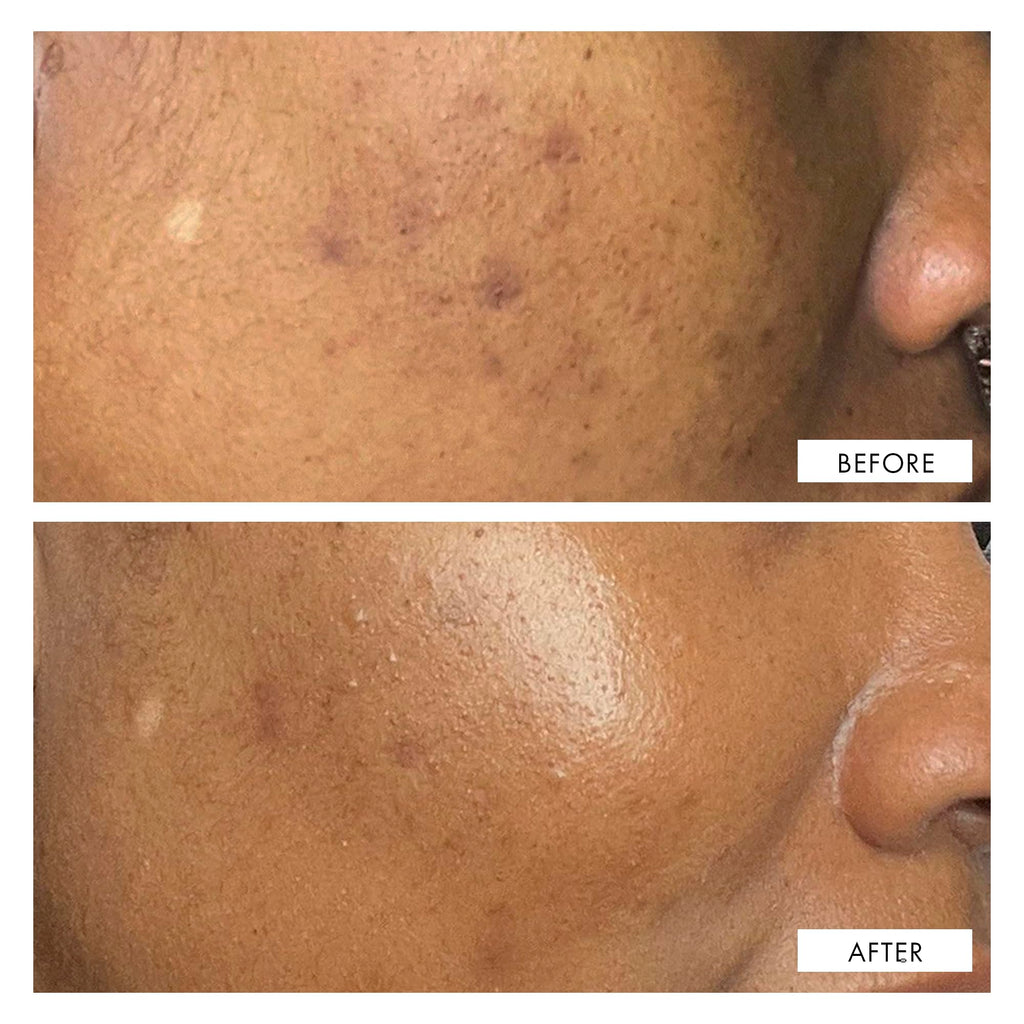 111SKIN Dark Spot Correcting Serum – Hydrating Solution for Uneven Skin Tone