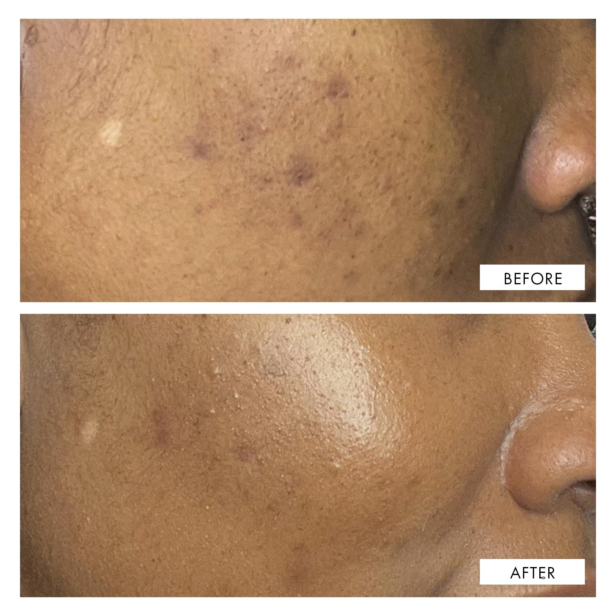 111SKIN Dark Spot Correcting Serum – Hydrating Solution for Uneven Skin Tone