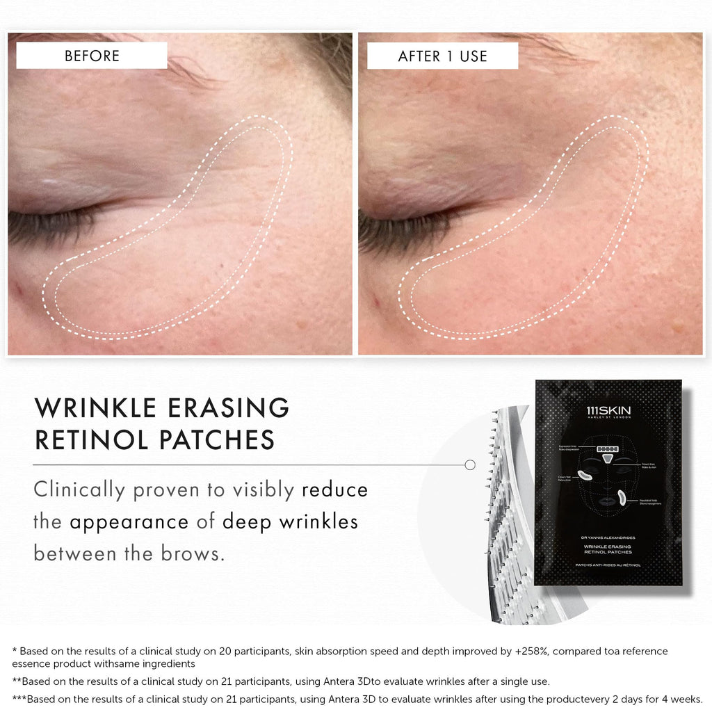 111SKIN Wrinkle Erasing Retinol Patches — Non-Invasive Forehead, Under-Eye & Smile Line, 3 x 1.23 oz
