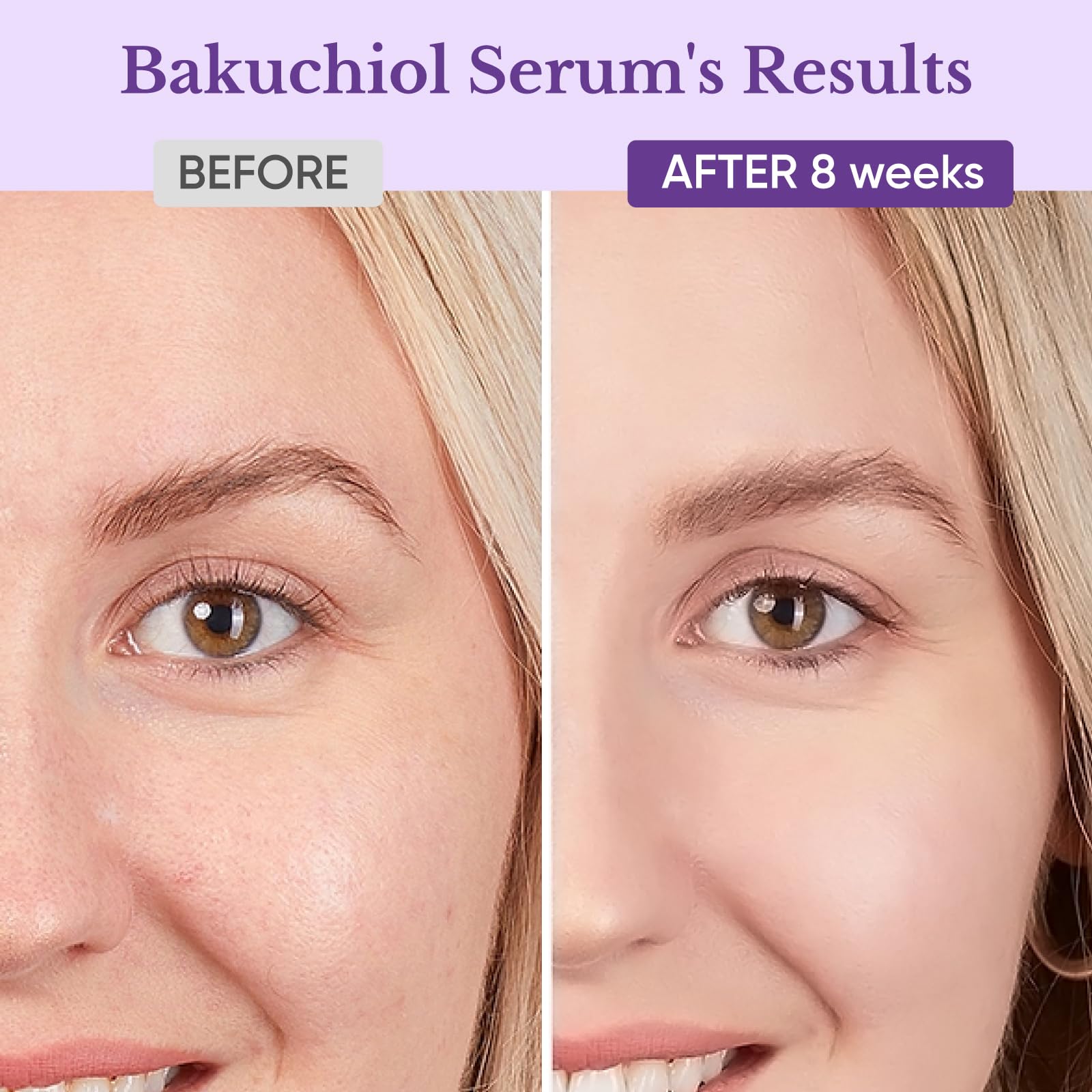 1HEROLABS Bakuchiol Serum – Gentle Retinol Alternative for Sensitive Skin, Vitamin E, Hyaluronic Acid & Collagen (1 oz)