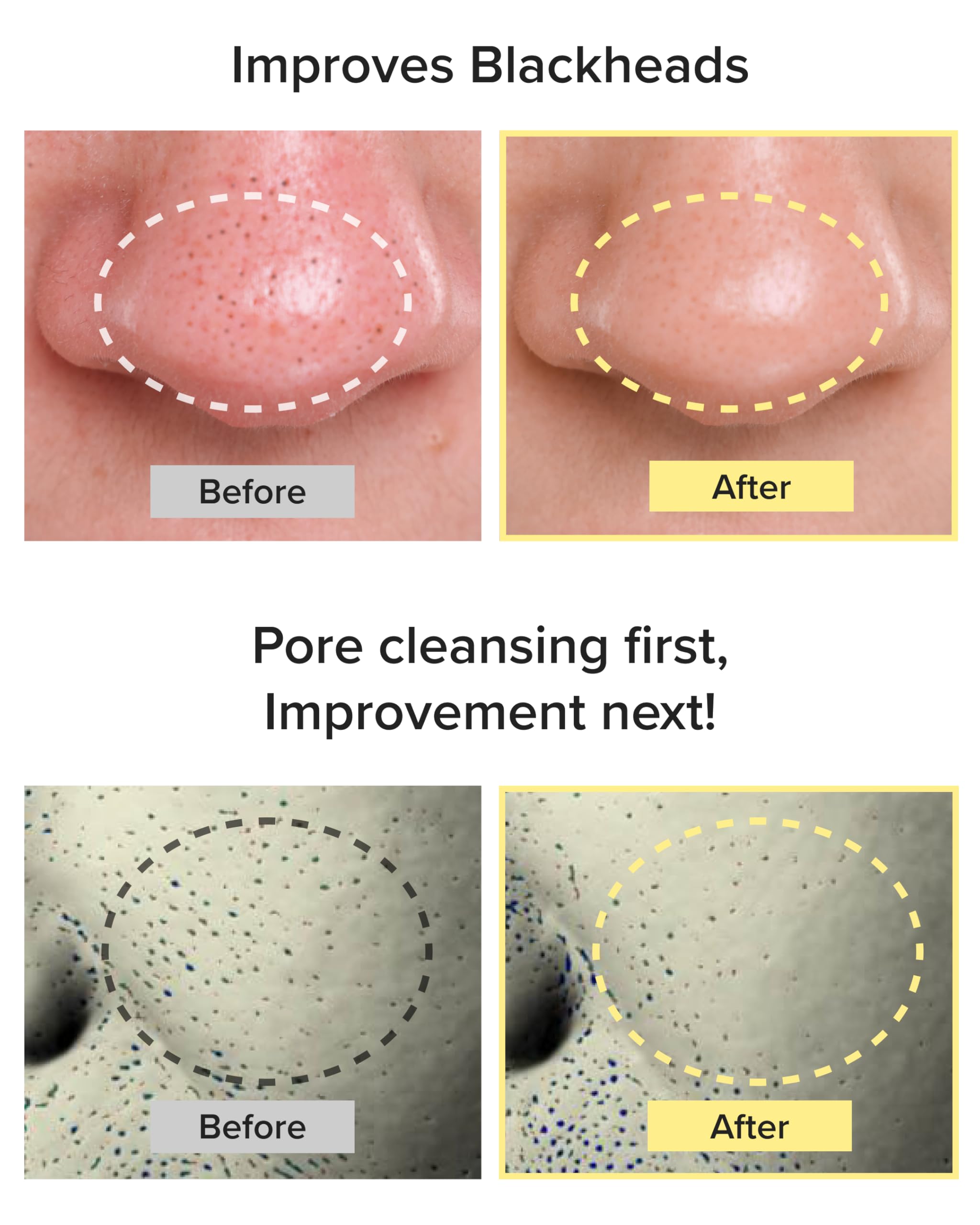 3W8L Deep Off & Fresh Cleansing Oil — Fast Emulsifying Korean Pore Care & Gentle Makeup Remover