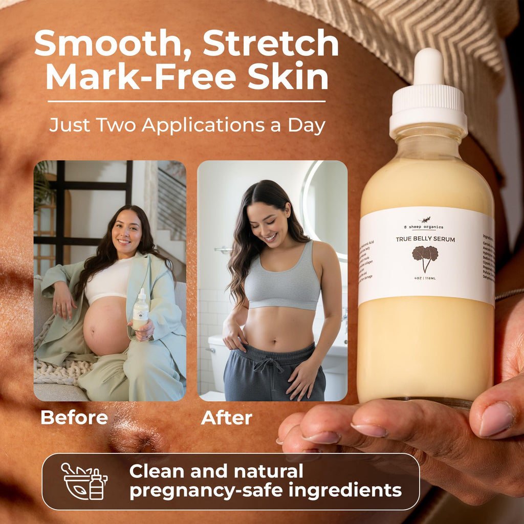 8 Sheep True Belly Serum – Pregnancy-Safe Skin Care with Centella & Hyaluronic Acid