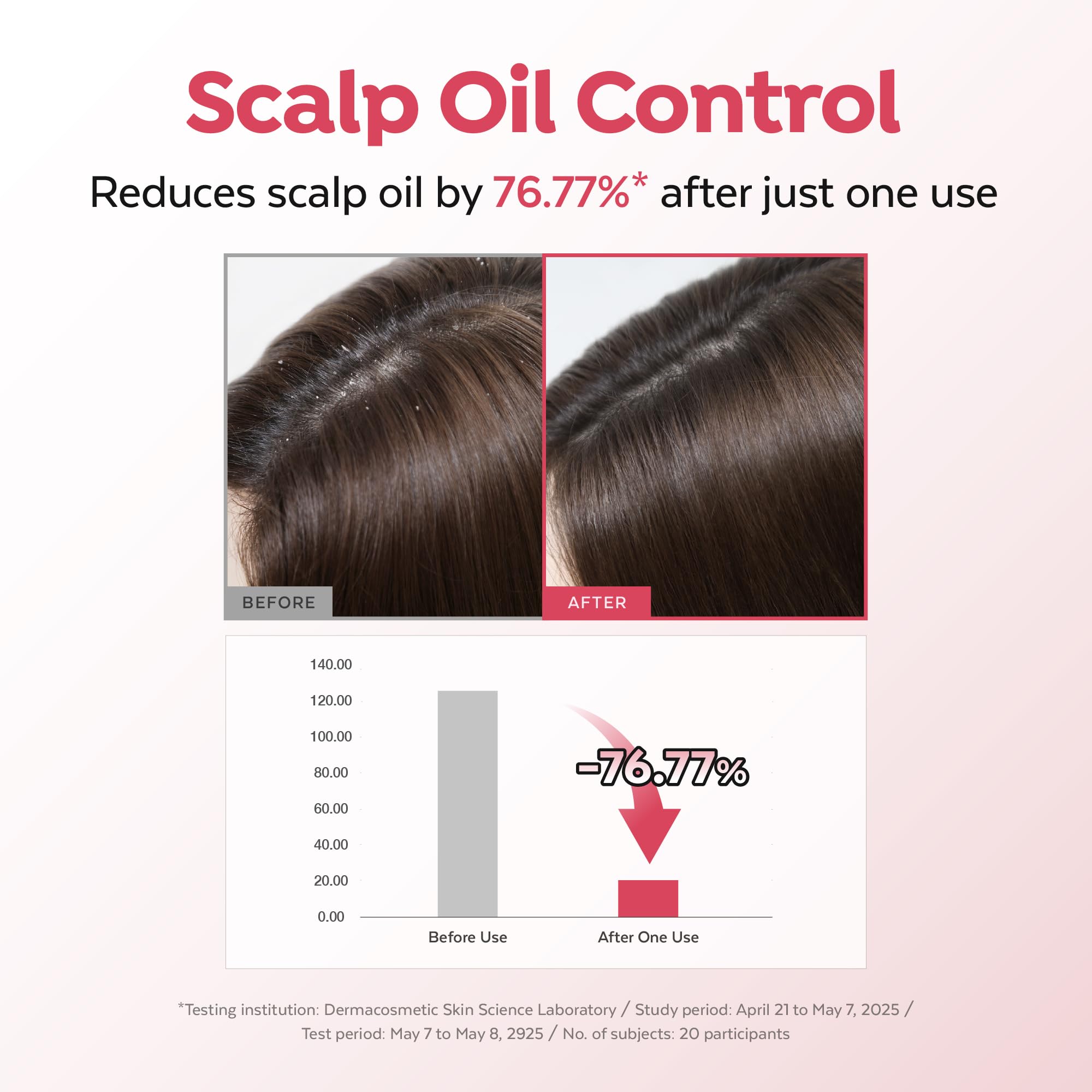 A'PIEU Raspberry Hair Vinegar Refill — Deep Scalp Detox and pH-Balanced Rinse for Oily Hair