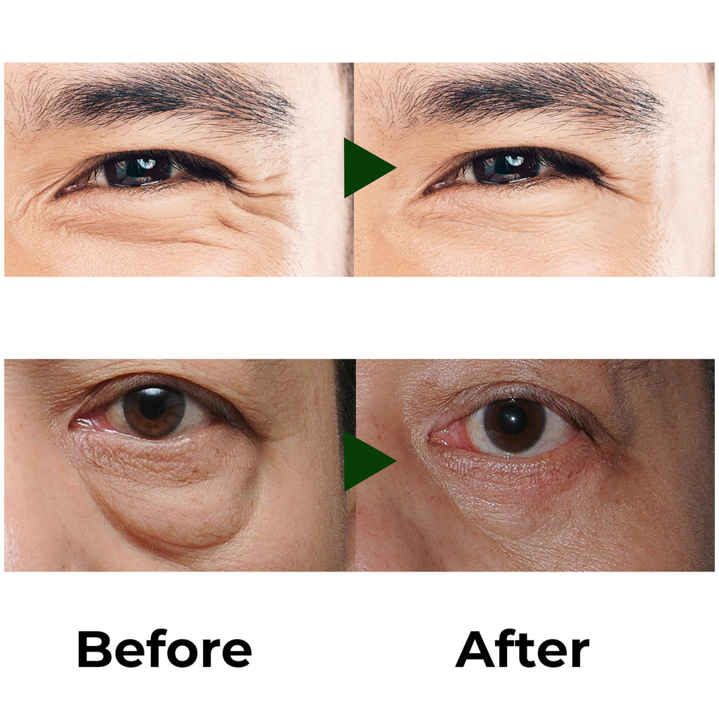 ABERA Eye Roller Serum for Men – Mint Essence, Vitamin C & Peptides | 0.34 fl oz