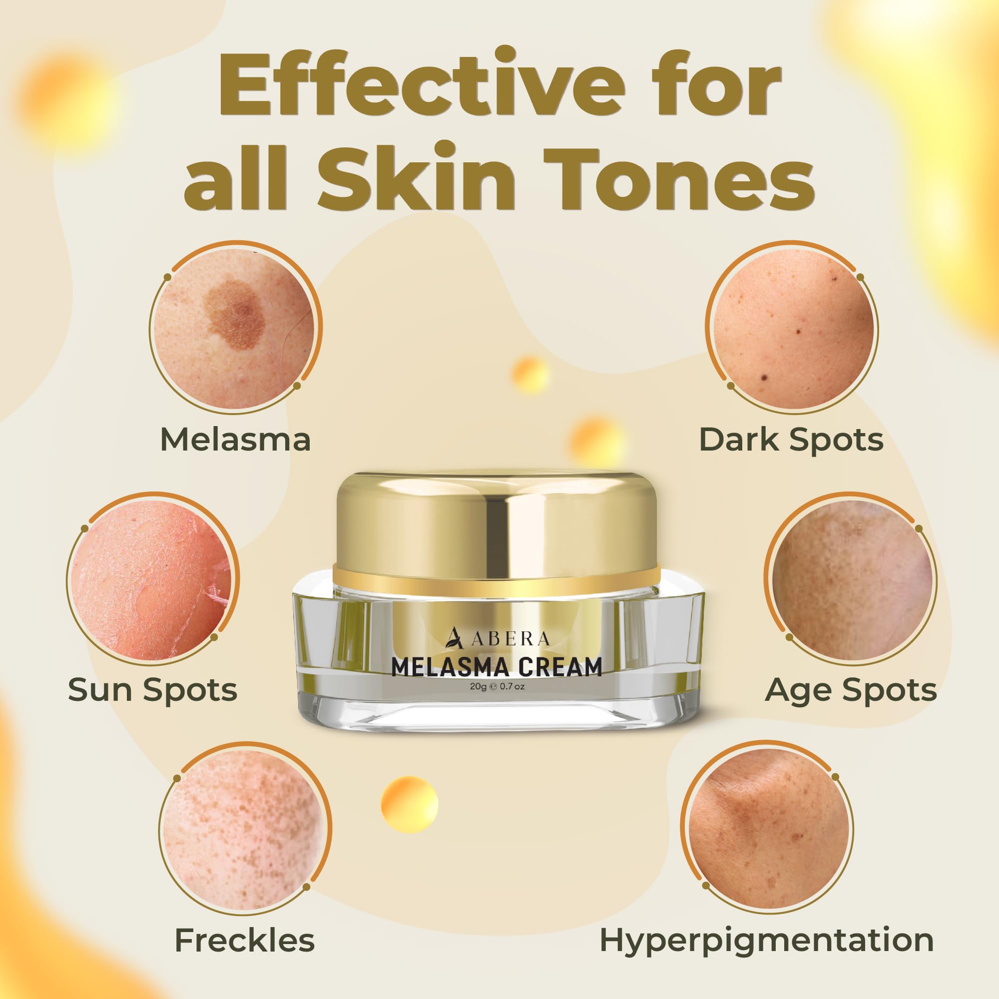 ABERA Melasma Cream - Dark Spot Corrector (0.7 oz) for Freckles, Sun Spots & Melasma