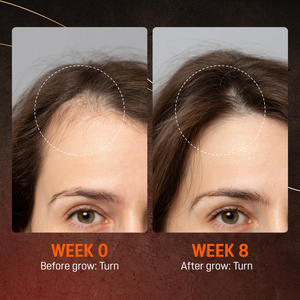 ABERA Hair Growth Serum – Natural Hair & Beard Support (Biotin & Castor Oil) | 1 Serum + Gift