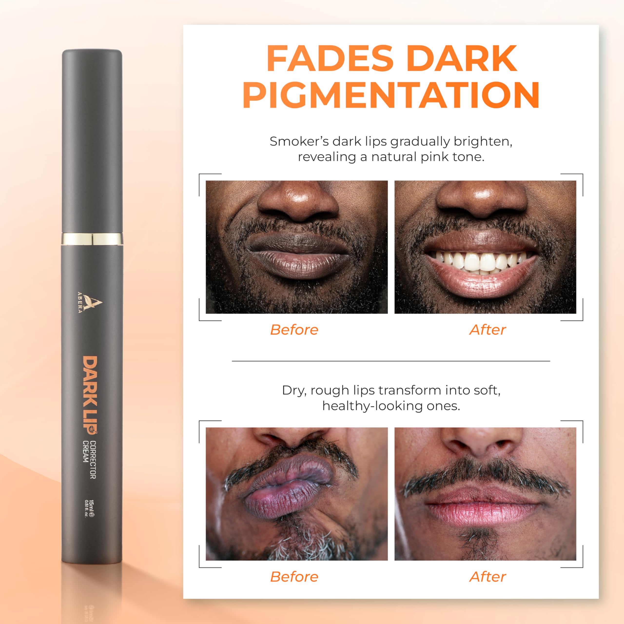 ABERA Dark Lips Corrector Cream – Lip Lightening & Moisturizing Plumper