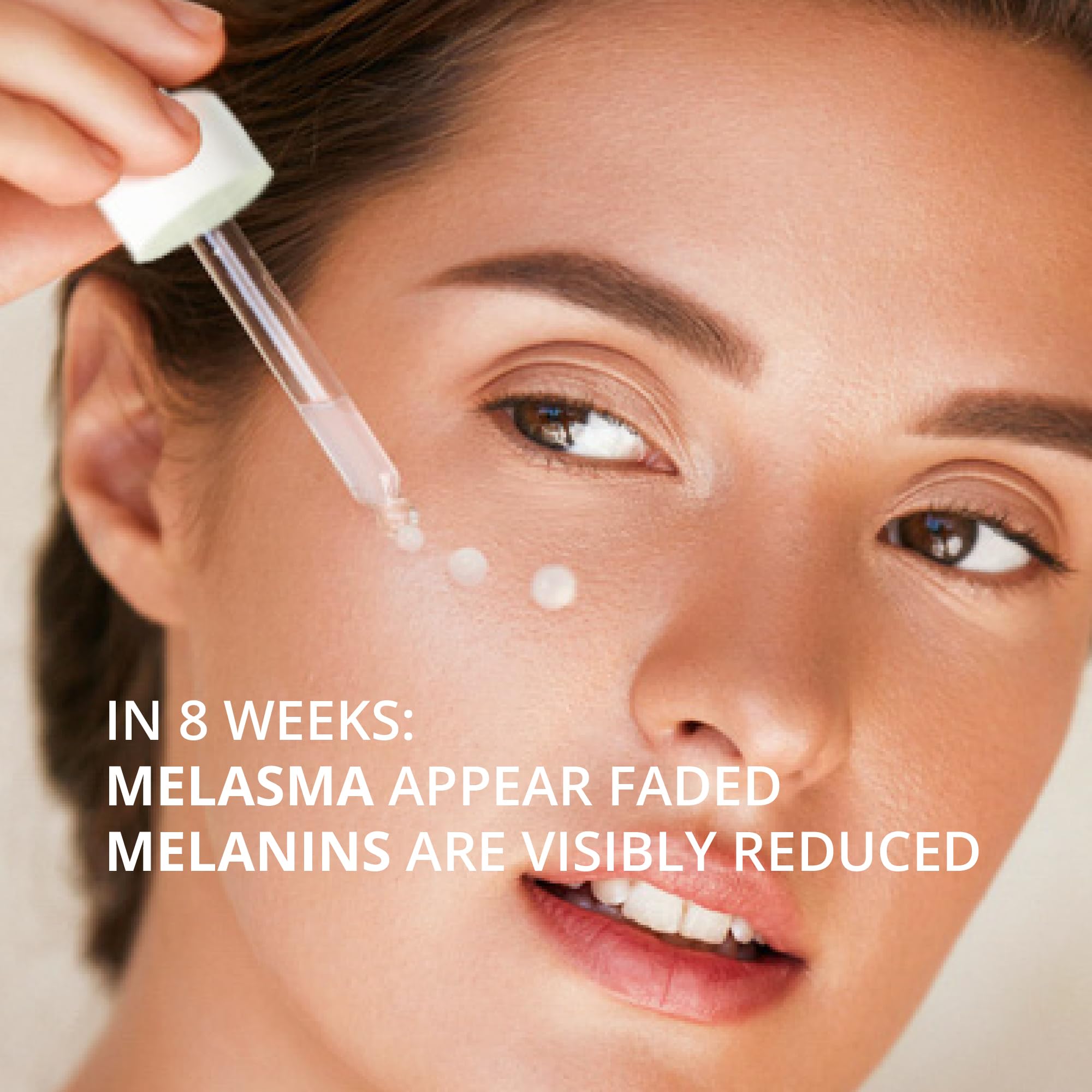ABERA Melasma Serum Plus – Melasma Treatment for Face, Dark Spot Remover, All Skin Tones (1 FL OZ)