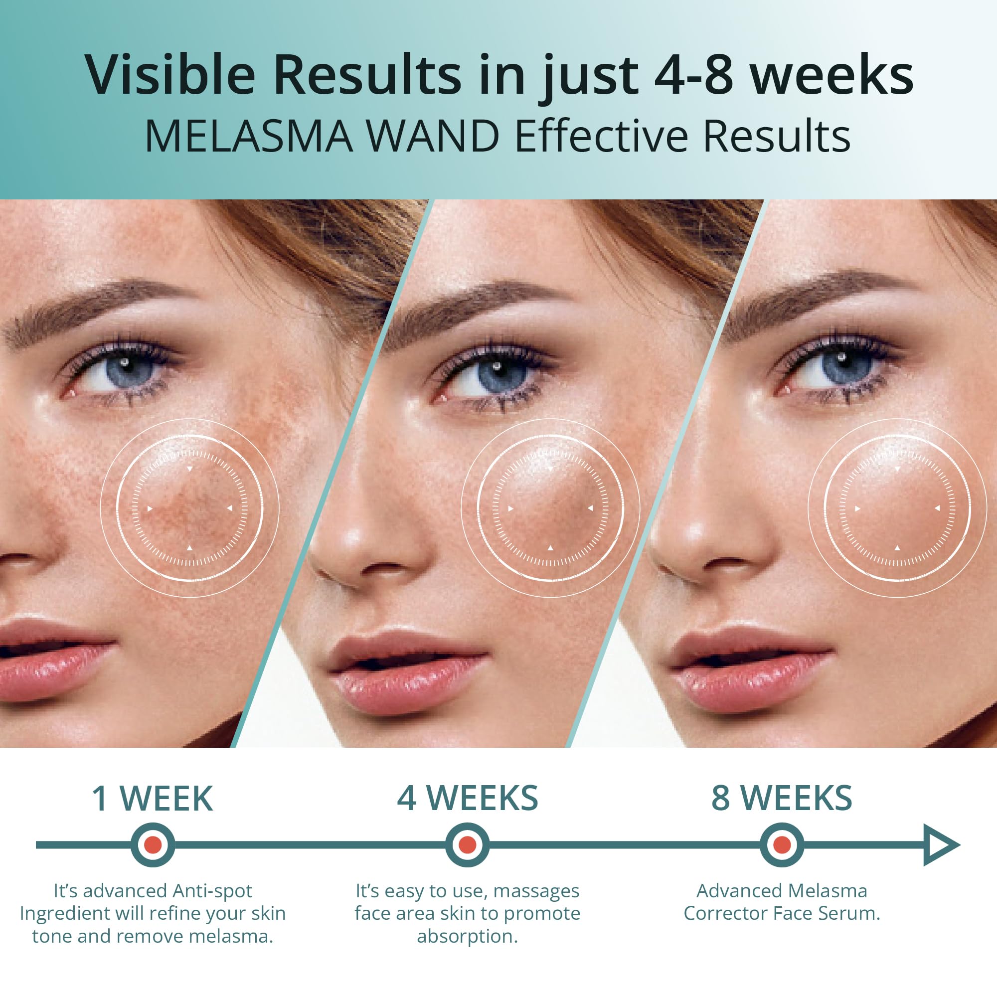 ABERA Melasma Serum Plus – Melasma Treatment for Face, Dark Spot Remover, All Skin Tones (1 FL OZ)