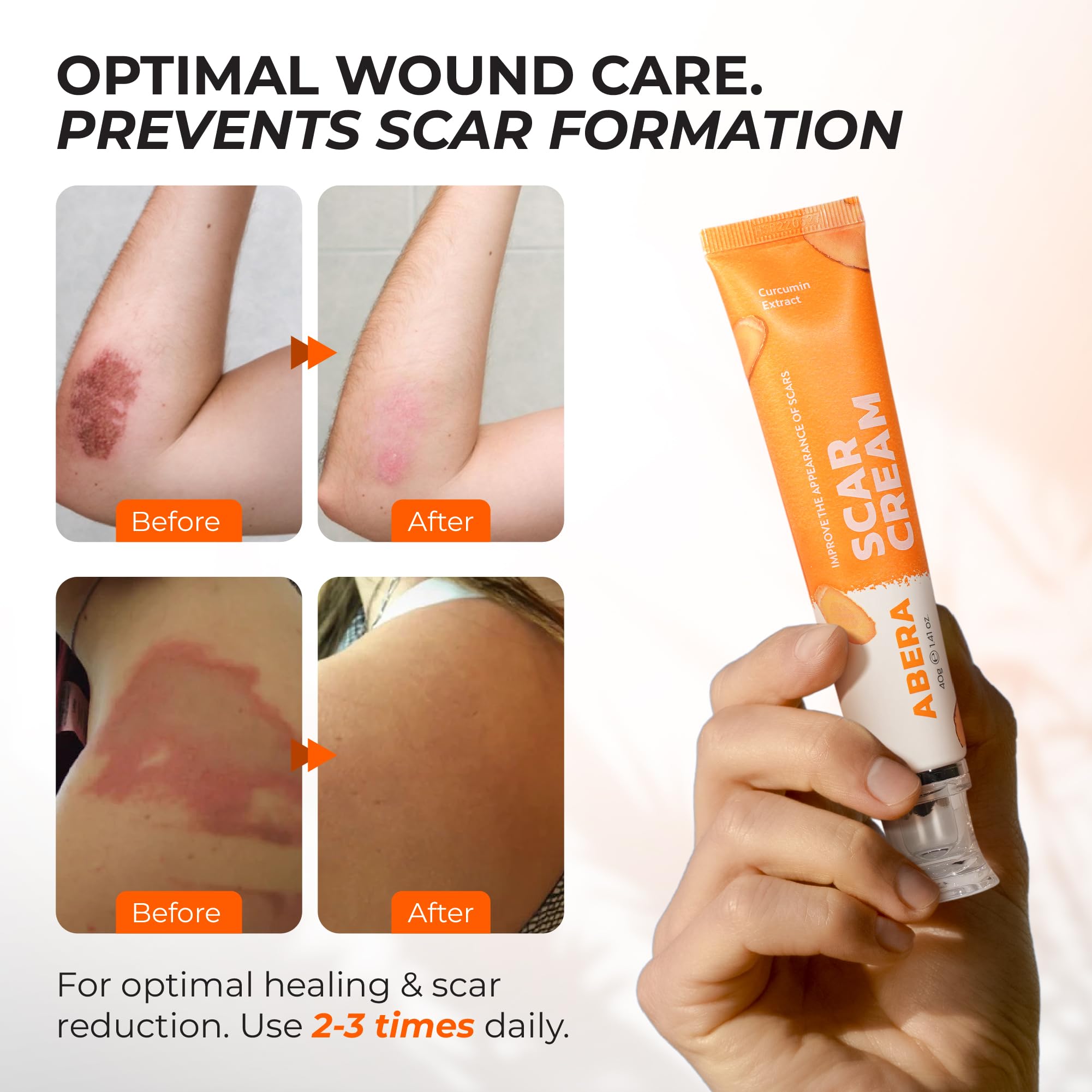 ABERA Scar Cream (Upgrade) – Skin Regeneration & Repair, 1.41 oz per Item (Set 2)