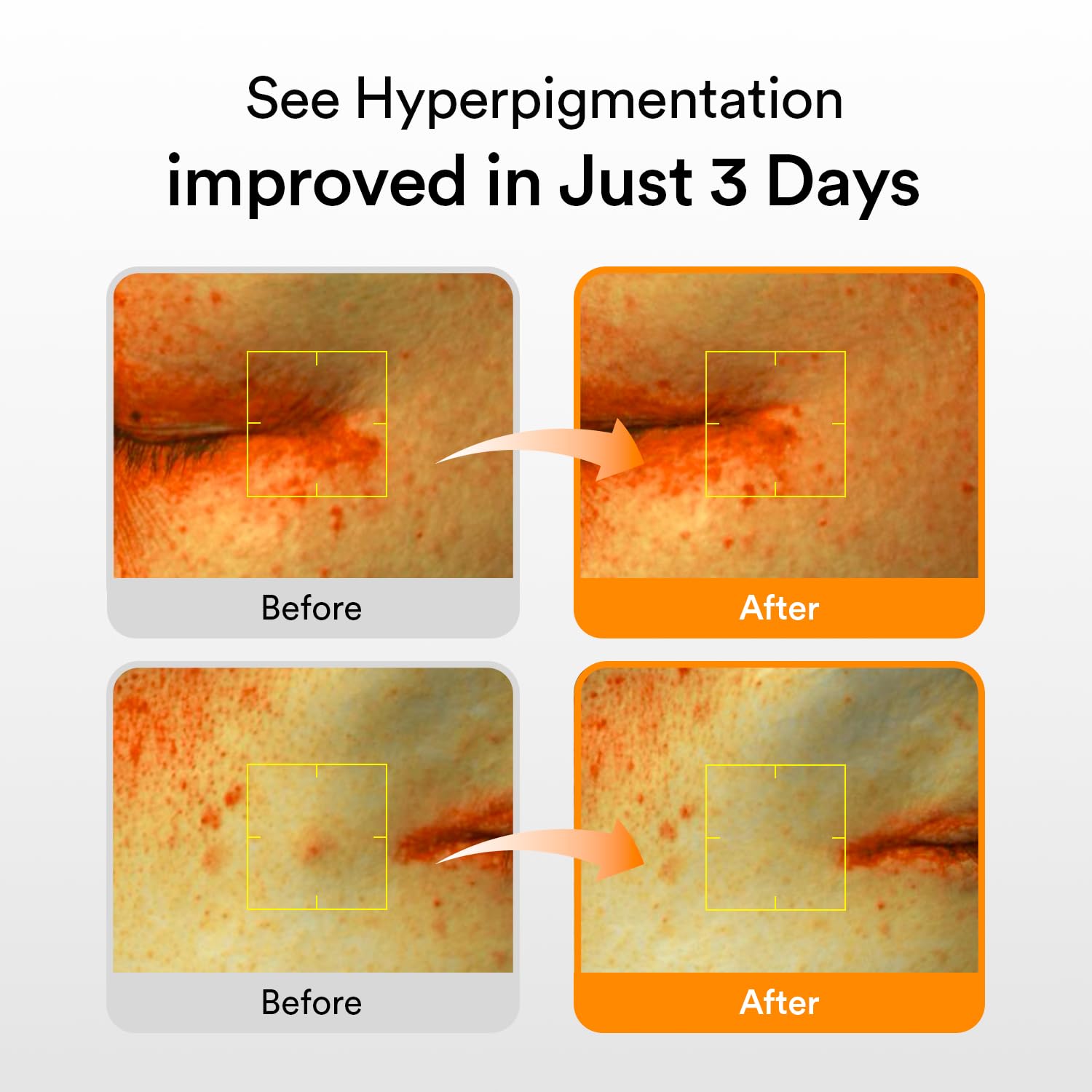 Abib Glutathiosome Dark Spot Serum Vita Drop 1.69 fl oz Korean Skincare for Hyperpigmentation & Sensitive Skin