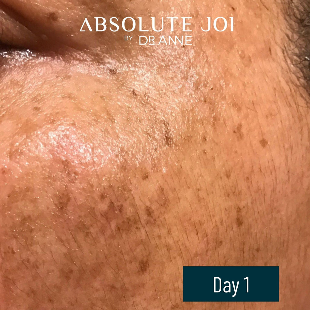 AbsoluteJOI Retinol Oil Serum with Vitamin C | Gentle Unscented Night Oil