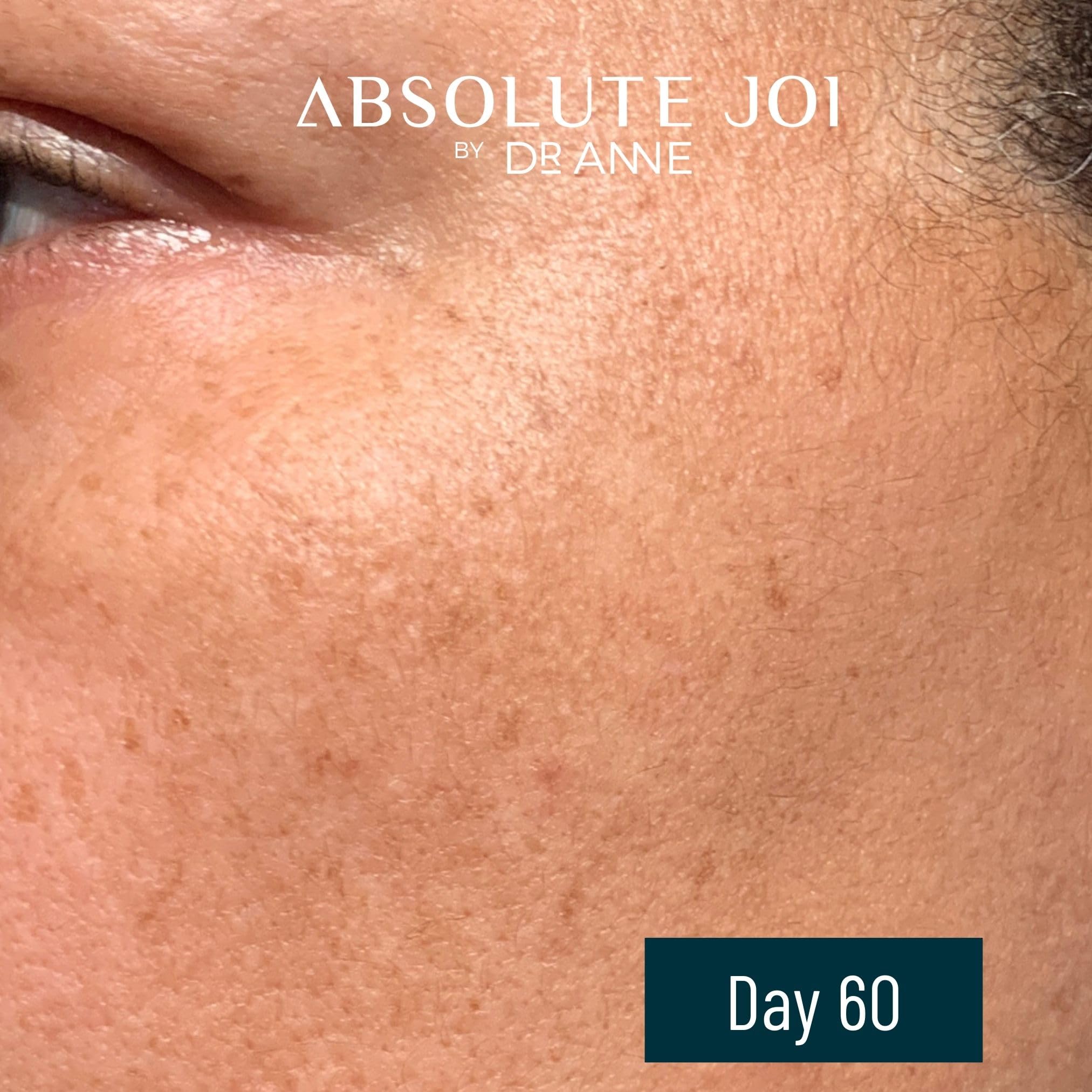 AbsoluteJOI Retinol Oil Serum with Vitamin C | Gentle Unscented Night Oil