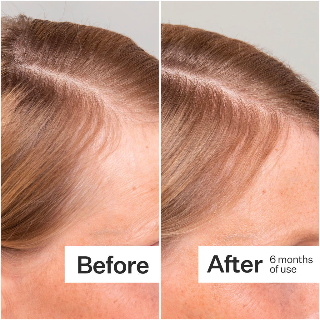 Act+Acre 3-Pack Mini Cold Processed Stem Cell Scalp Serum – Thicker, Fuller-Looking Hair