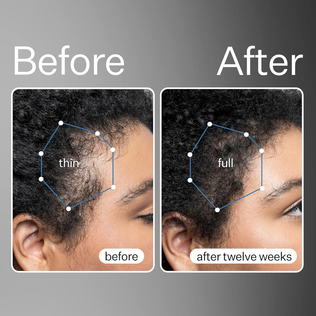 Act+Acre 3-Pack Mini Cold Processed Stem Cell Scalp Serum – Thicker, Fuller-Looking Hair