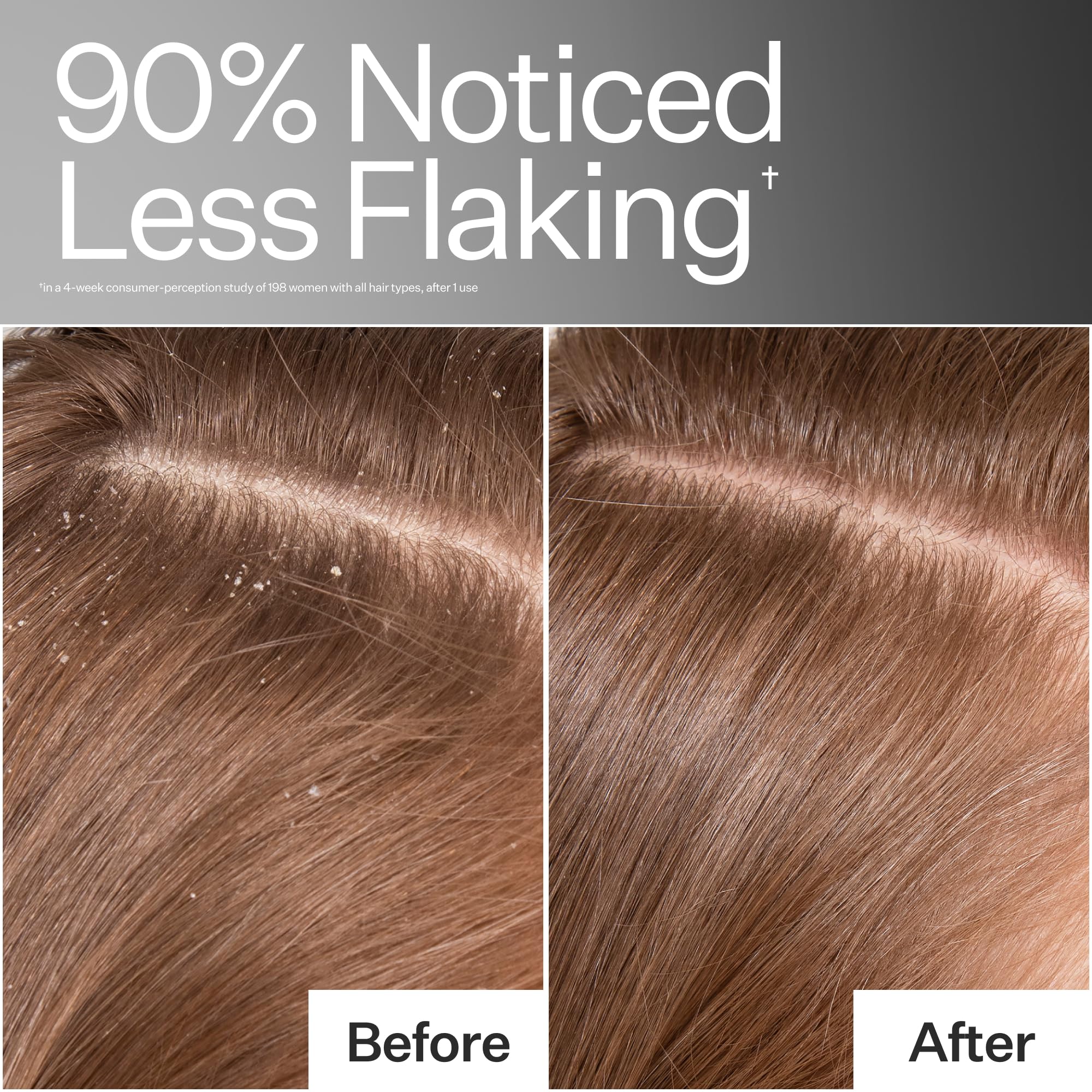 ACT+ ACRE Cold Processed Scalp Detox Oil — Sulfate-Free Scalp Care for Flaky, Dry & Itchy Scalp
