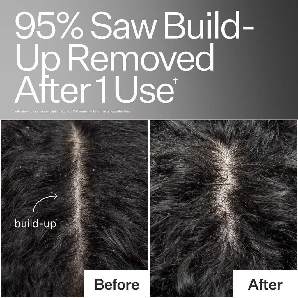 ACT+ ACRE Cold Processed Scalp Detox Oil — Sulfate-Free Scalp Care for Flaky, Dry & Itchy Scalp