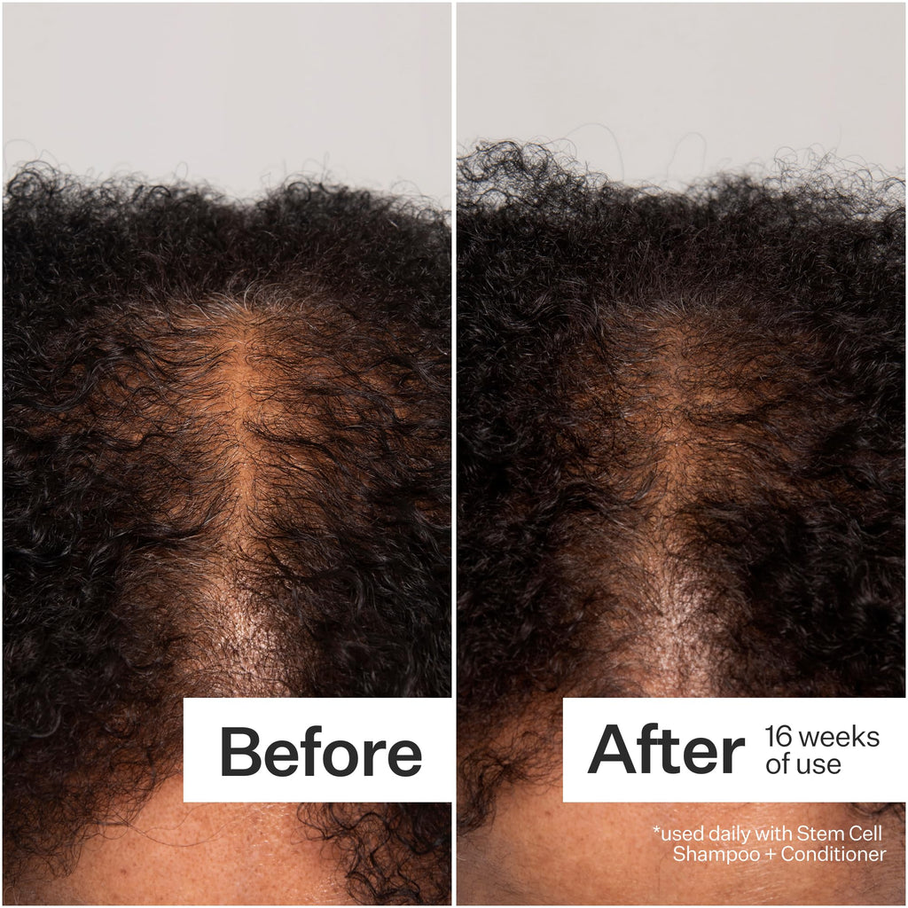 Act+Acre Cold Processed 3% Stem Cell Peptide Treatment – Boost Hair Density | Grape Stem Cells, Peptides + Caffeine | Vegan, Fragrance-Free | 3 fl oz