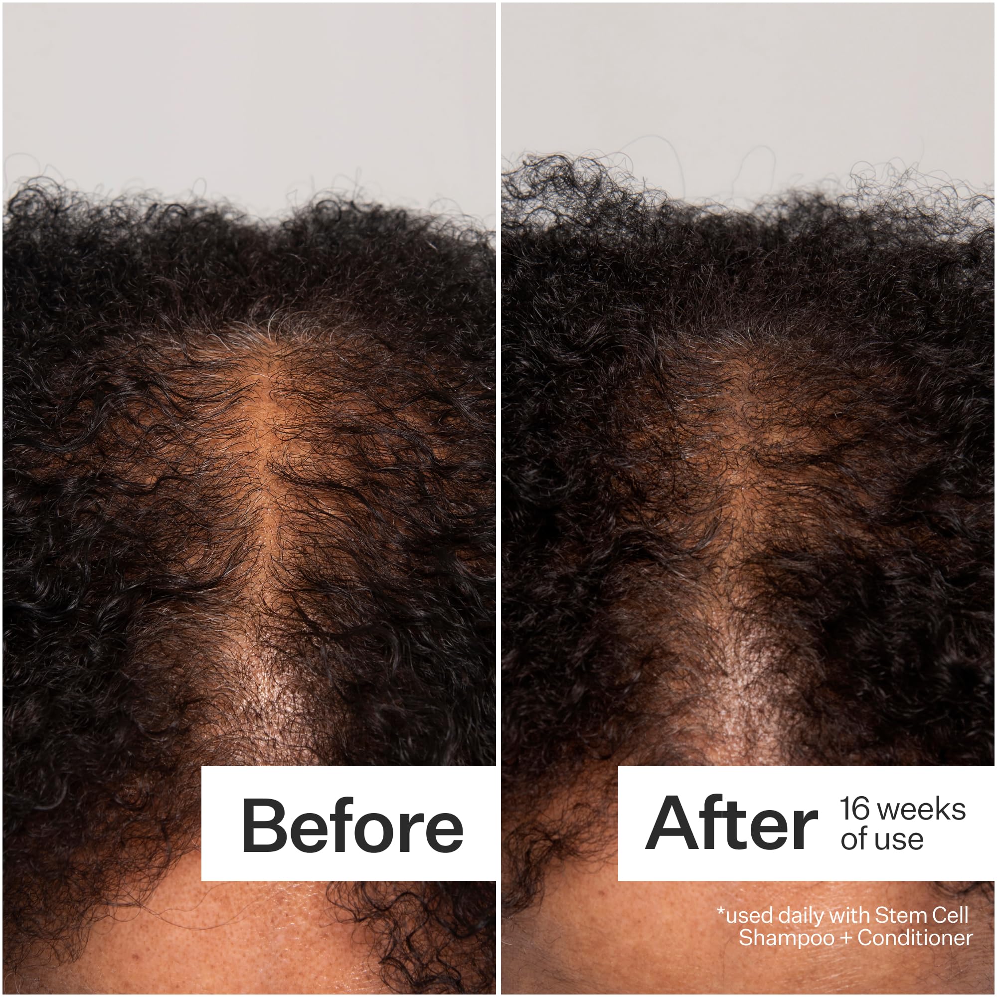 Act+Acre Cold Processed 3% Stem Cell Peptide Treatment – Boost Hair Density | Grape Stem Cells, Peptides + Caffeine | Vegan, Fragrance-Free | 3 fl oz