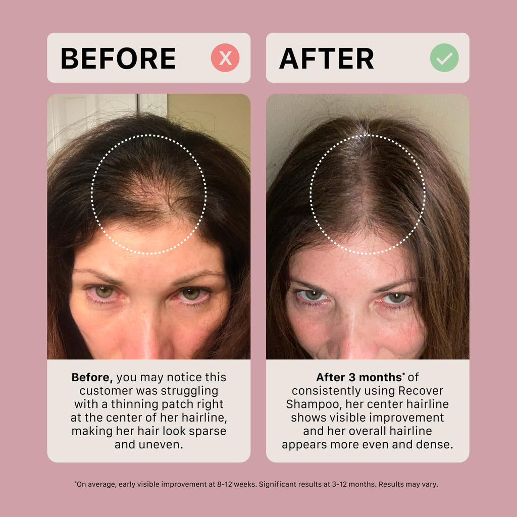 ACTIIV Recover Thickening Shampoo for Women | Fuller Hair, Plant-Based