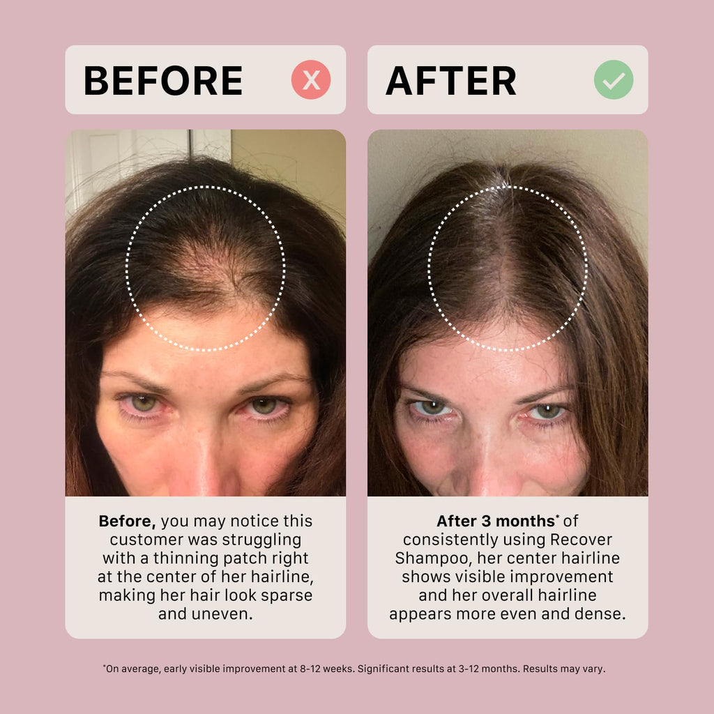 ACTIIV Recover Travel Duo for Women – Fuller-Looking Hair, Plant-Based, Color-Safe (2x2.7 oz)