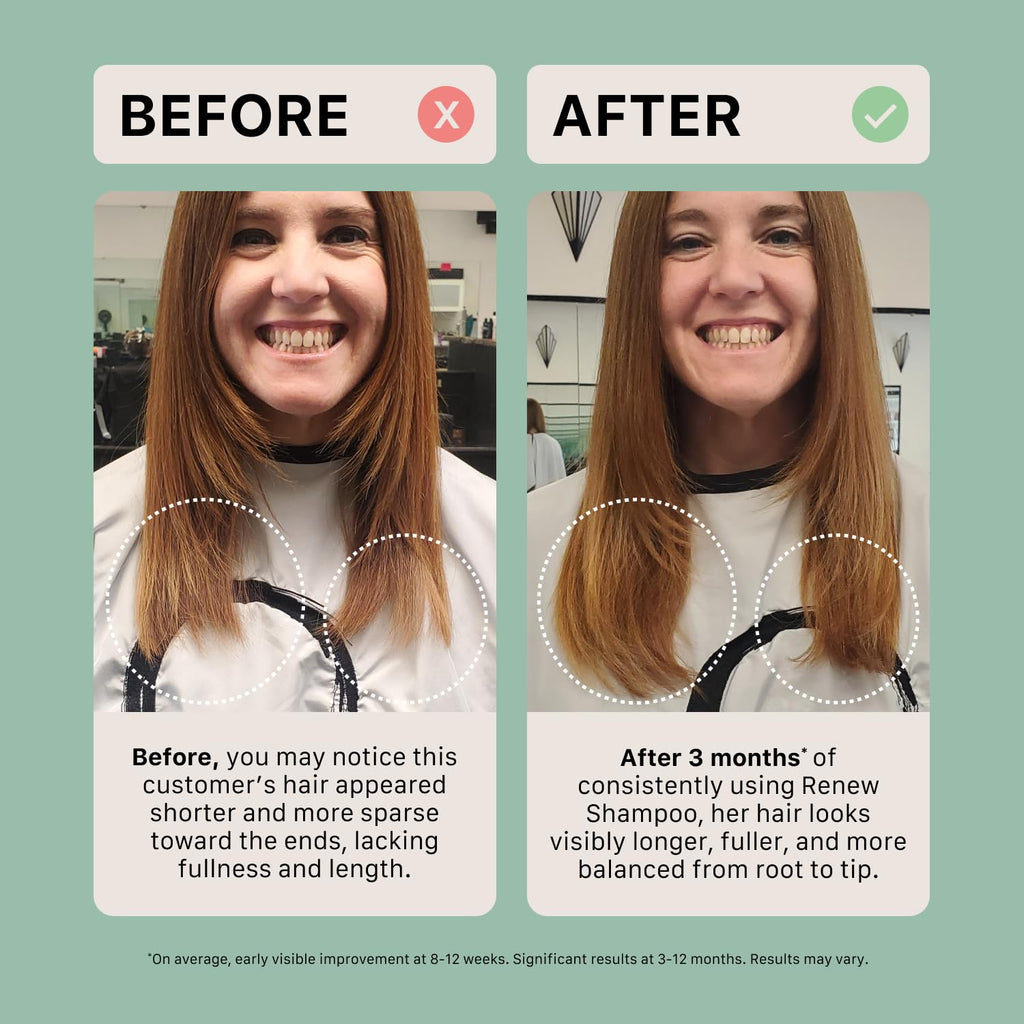 ACTIIV Renew Healing Shampoo Treatment | Plant-Based, Color-Safe Care for Damaged Hair (80 mL)