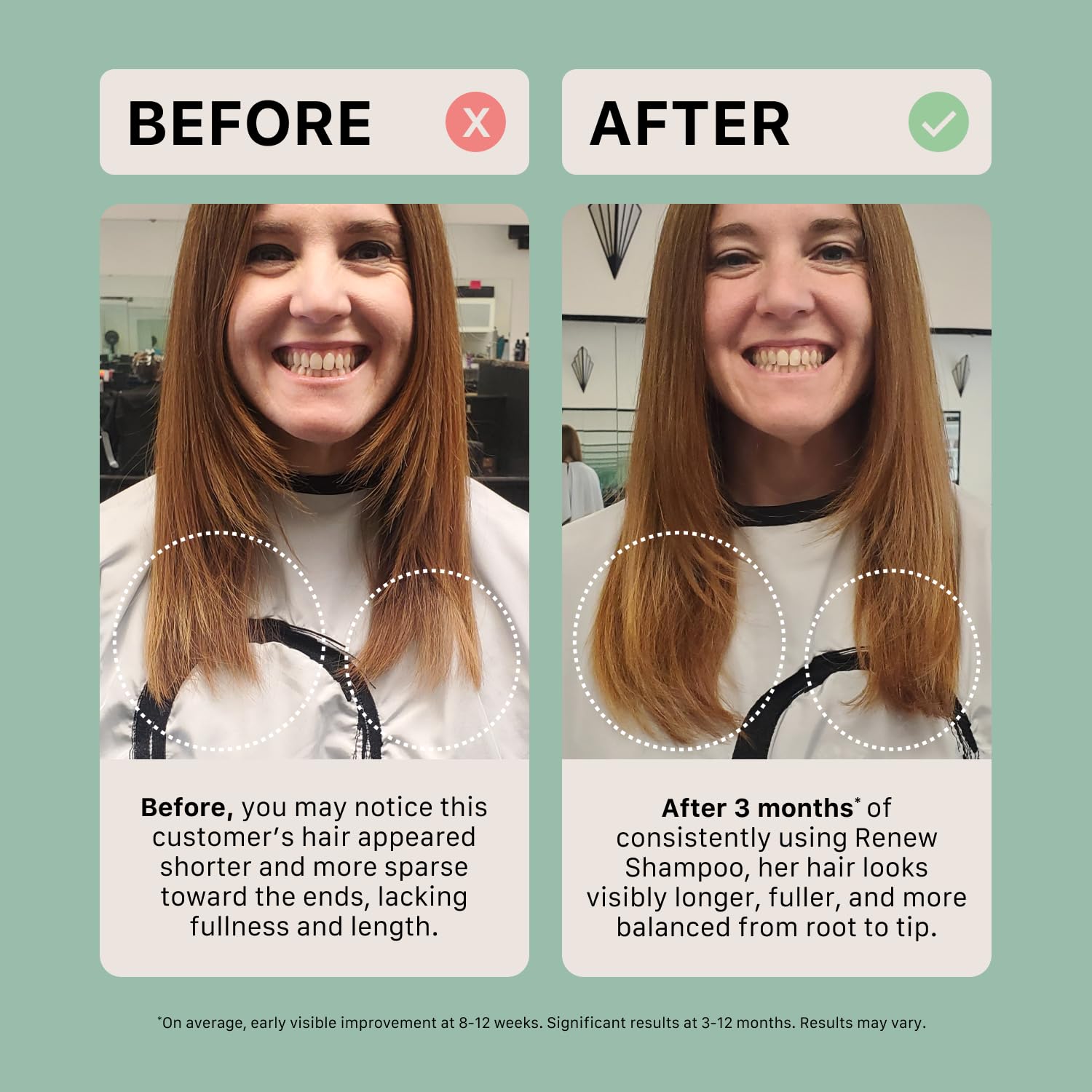 ACTIIV Renew Healing Shampoo Treatment | Plant-Based, Color-Safe Care for Damaged Hair (80 mL)