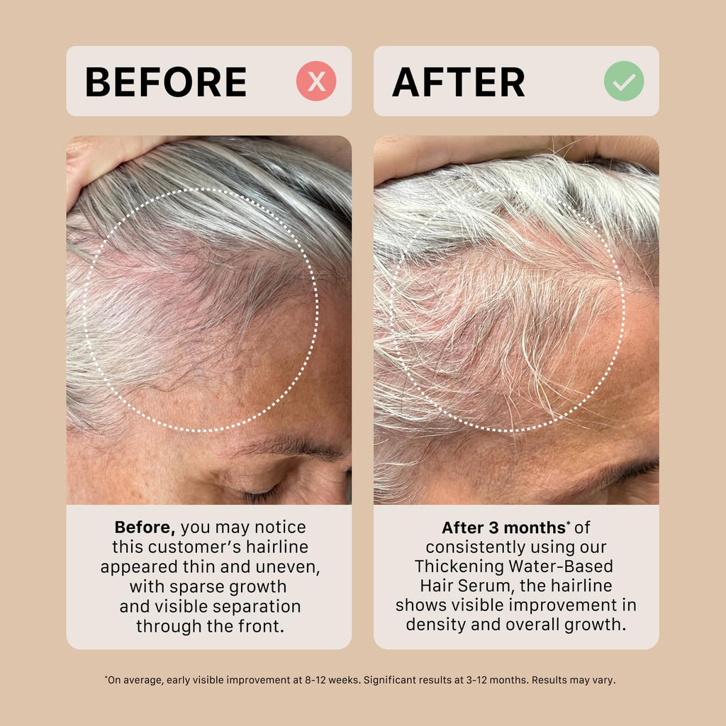 ACTIIV Ultimate Power Trio for Women – Fuller Hair, Scalp Care, Vegan & Color-Safe