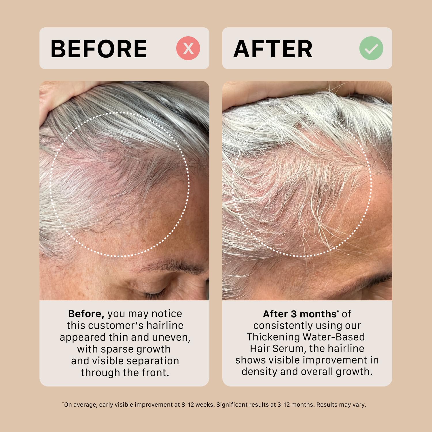 ACTIIV Ultimate Power Trio for Women – Fuller Hair, Scalp Care, Vegan & Color-Safe