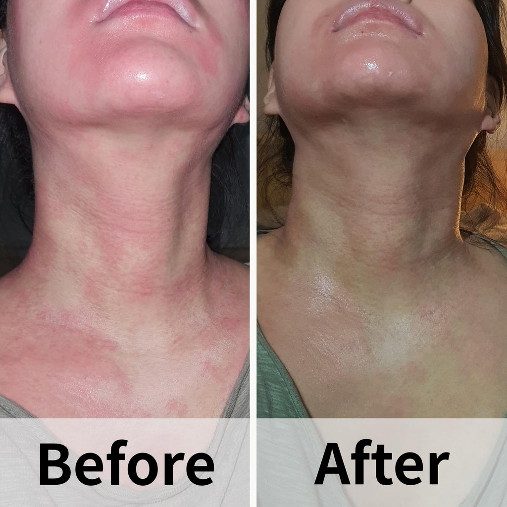 AD SOLUTION ATO Fast Calming Serum for Sensitive Skin | Itch Relief & Hydration