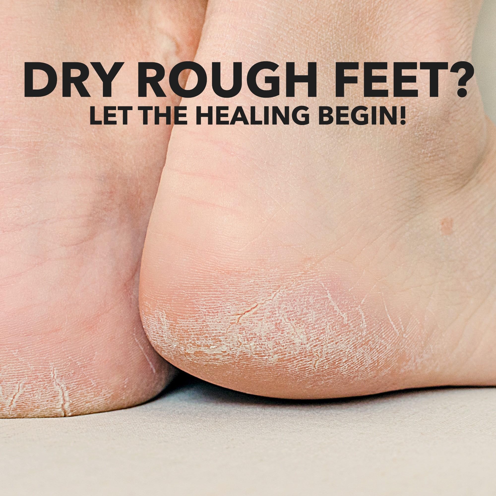 Adamia Therapeutic Repair Foot Cream with Pure Macadamia Oil – Fragrance Free, 4 oz