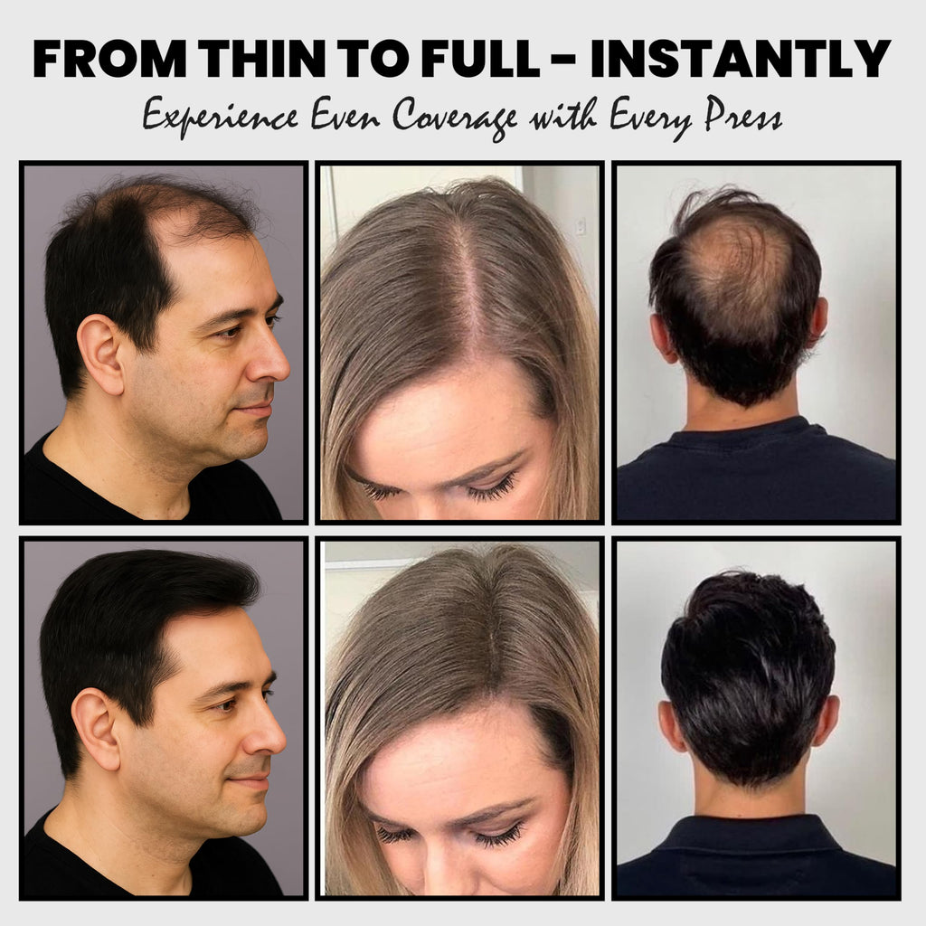 Adglamful Hair Fibers 2-Pack – Instant Coverage for Thinning Hair (Medium Brown)