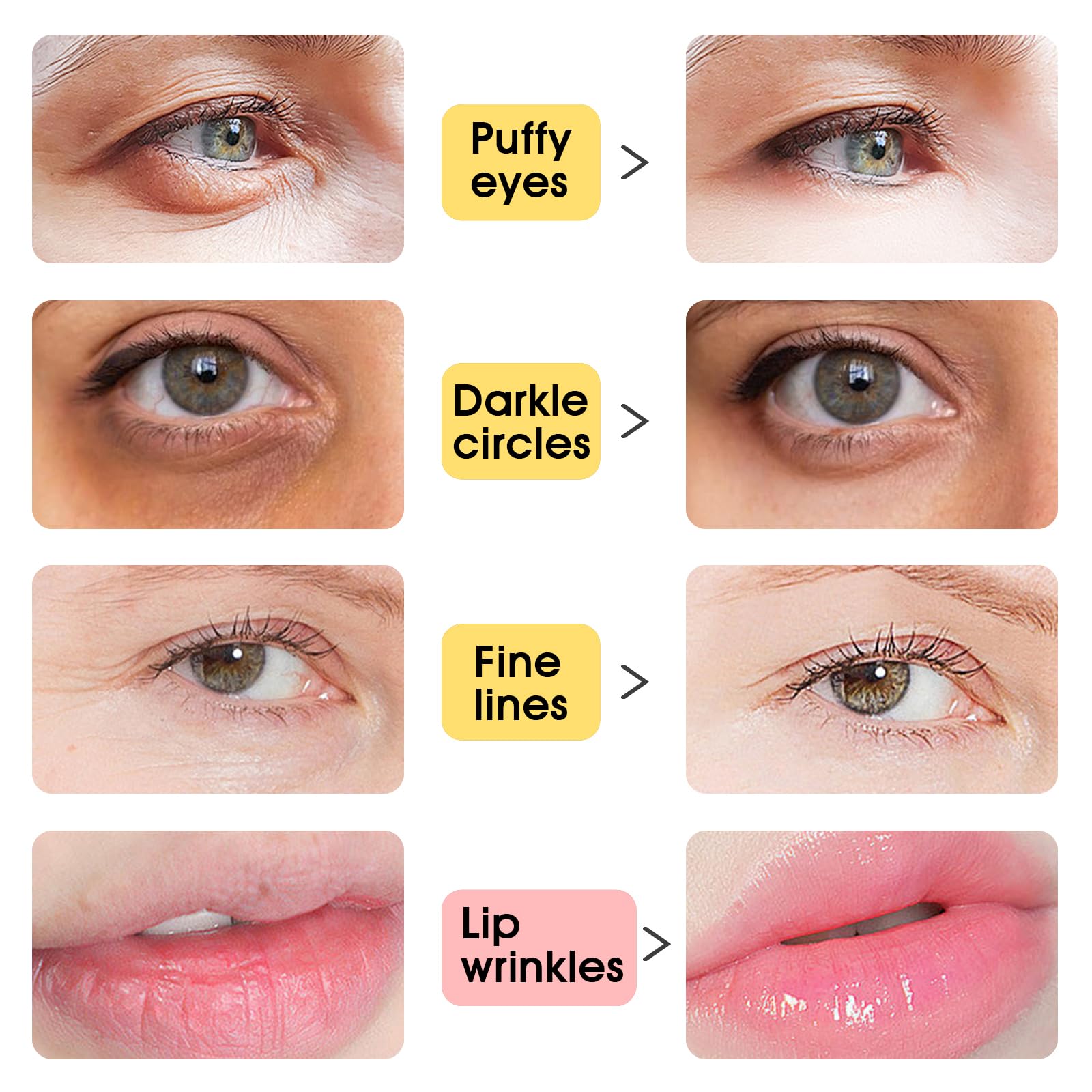 Adofect Collagen Lip & Eye Mask Set – Hydrating, Revitalizing (40 Pairs)