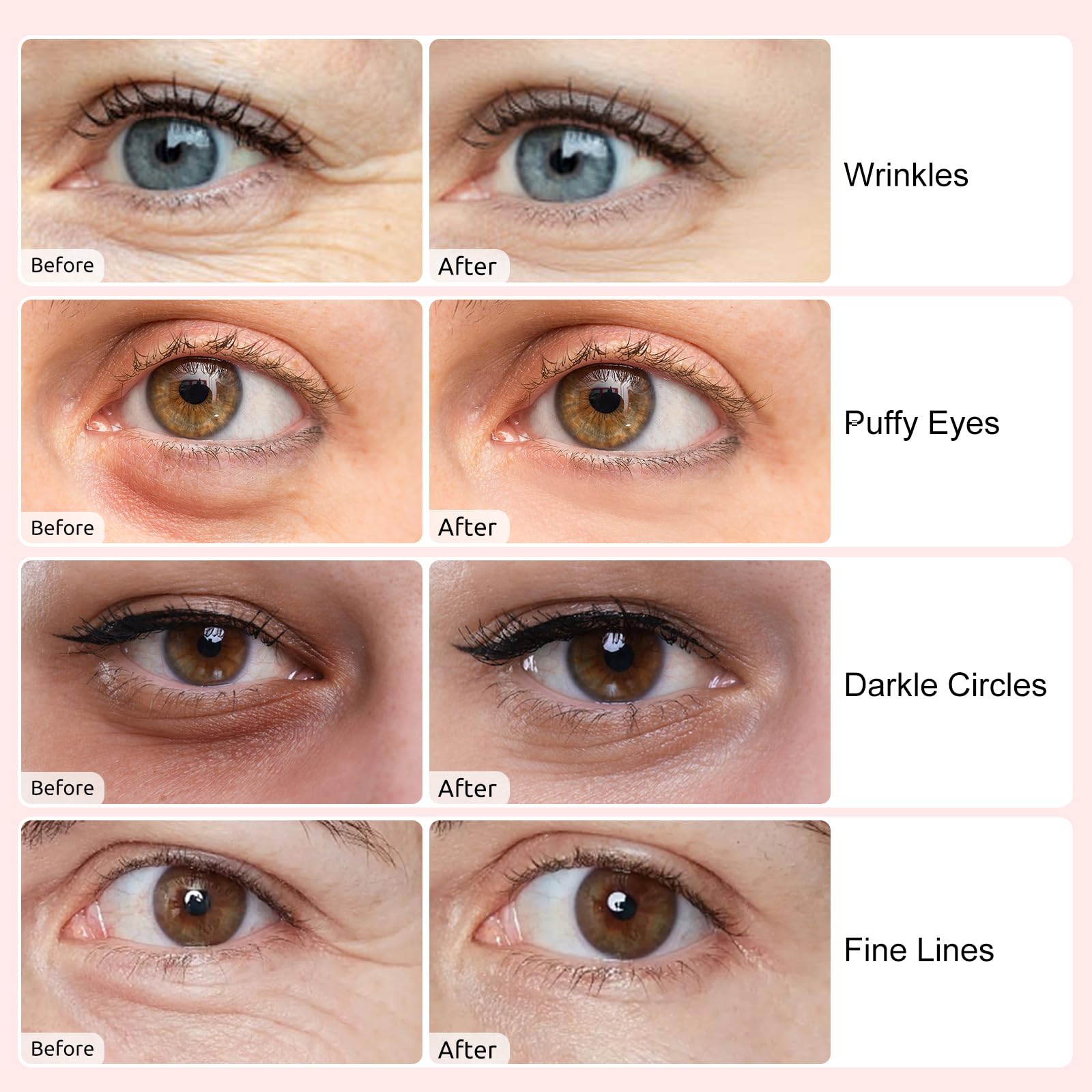 Adofect Under Eye Patches – 40 Pairs Collagen & Hyaluronic Acid Mask