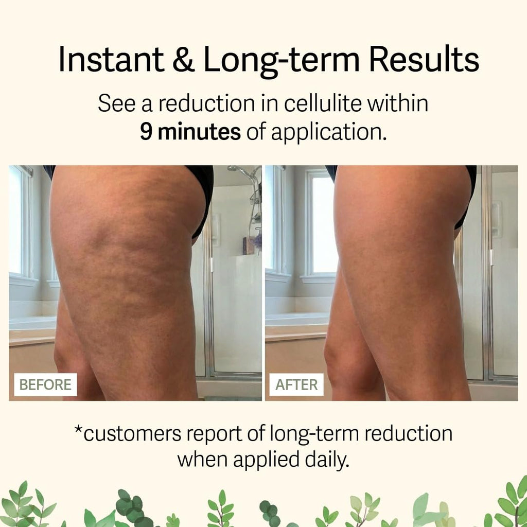 Adonia Organics LegTone – Organic Cellulite Cream for Firmer, Smoother Skin