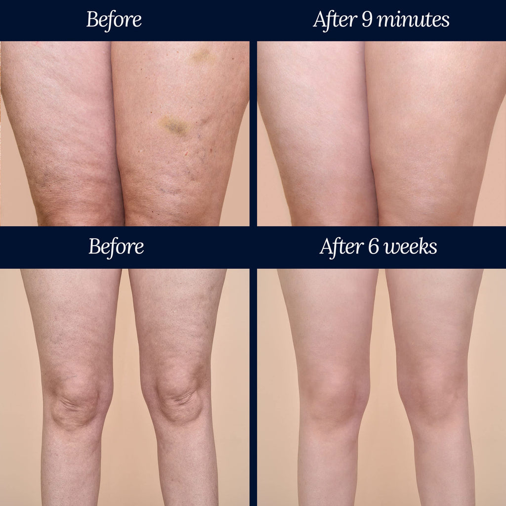 Adonia Organics LegTone – Organic Cellulite Cream for Firmer, Smoother Skin