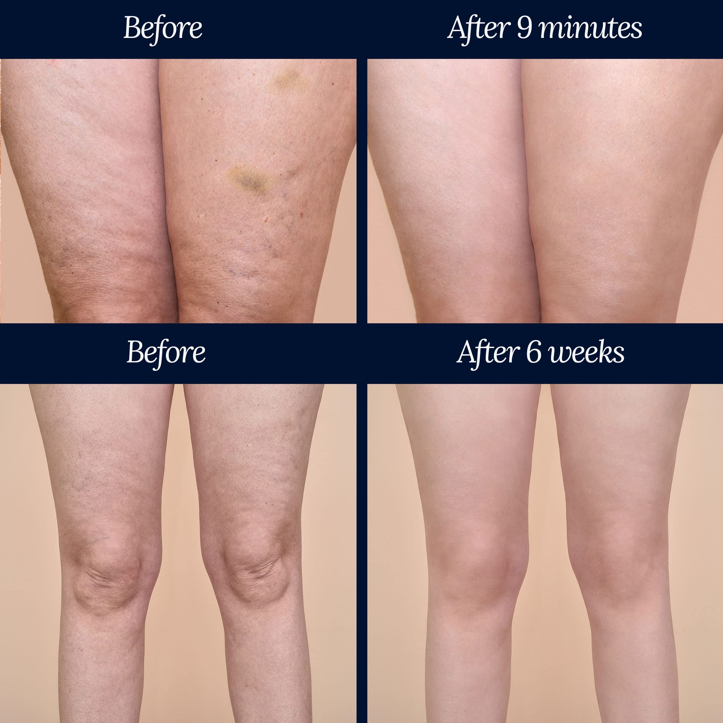 Adonia Organics LegTone – Organic Cellulite Cream for Firmer, Smoother Skin
