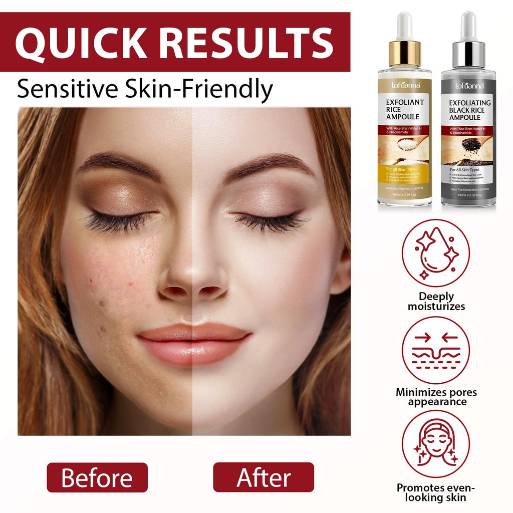 ADSBJUX Rice Peel Shot Glow Duo – White & Black Rice Exfoliant for Face & Body