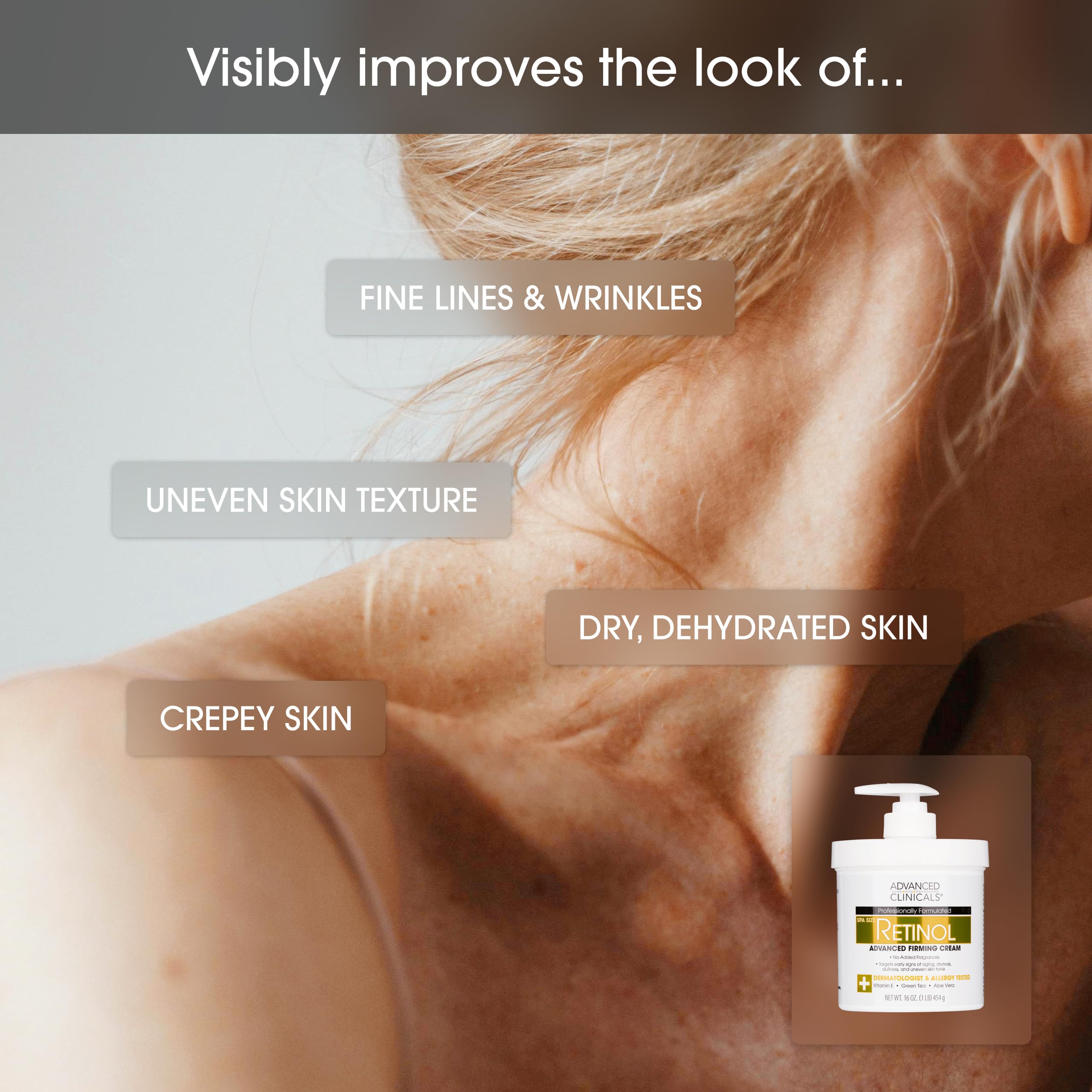 Advanced Clinicals Retinol Body Cream + Vitamin C Body Lotion 2pc Set – Firm, Brighten, Hydrate