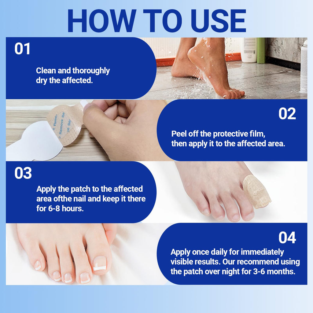 Aedydyce Toenail Fungus Treatment Extra Strength – 42 Patches (Two Packs of 21)
