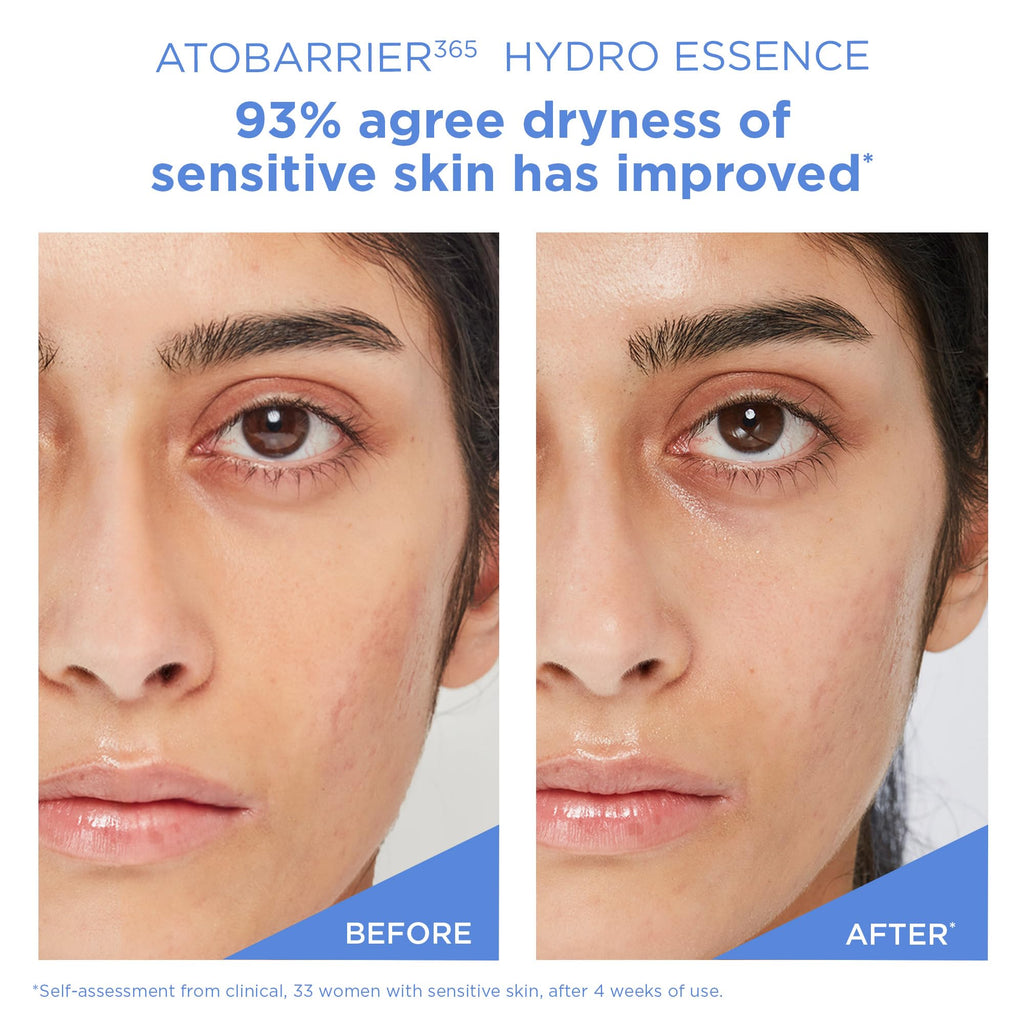 AESTURA ATOBARRIER365 Hydro Essence – Lightweight Hydration & Barrier Support for Dry & Sensitive Skin | 100 ml