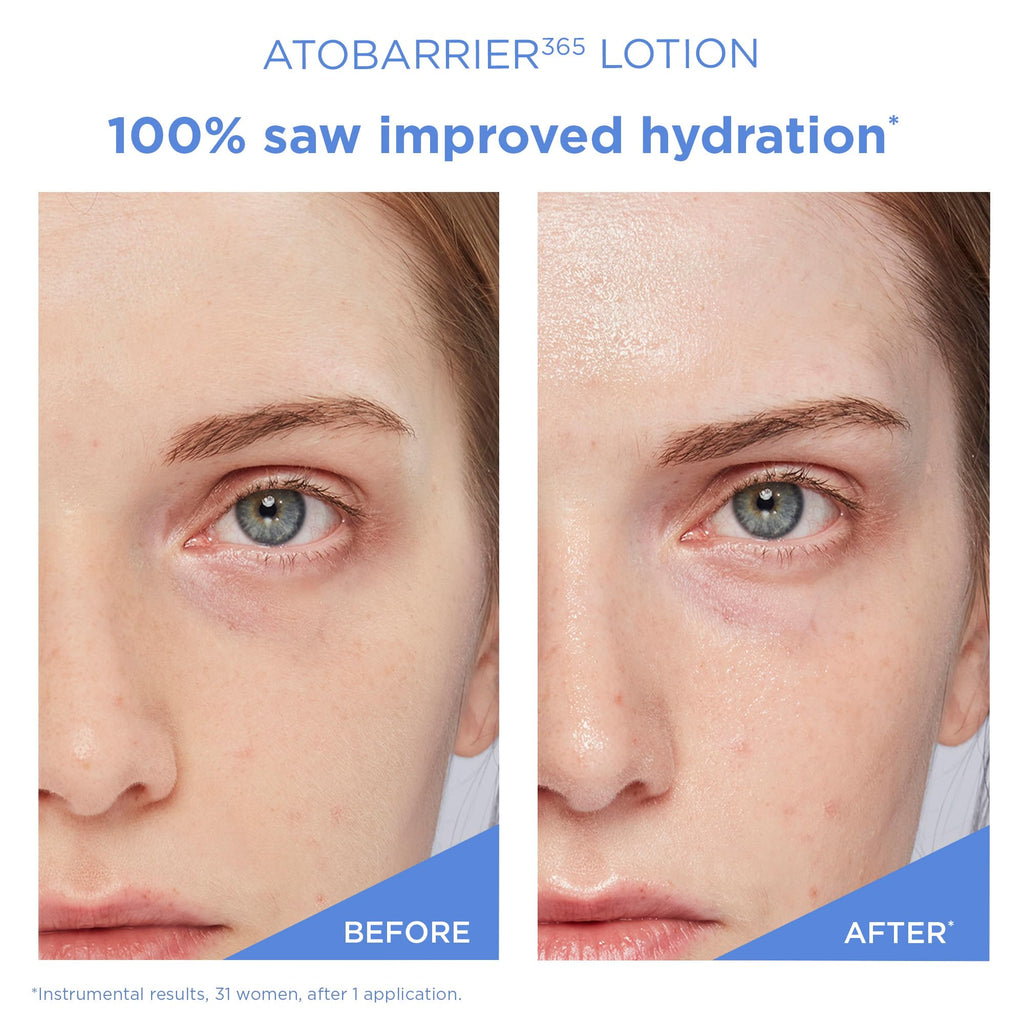 AESTURA ATOBARRIER365 Lightweight Moisturizer with Ceramides | Barrier Support + Hydration for Dry, Normal & Sensitive Skin