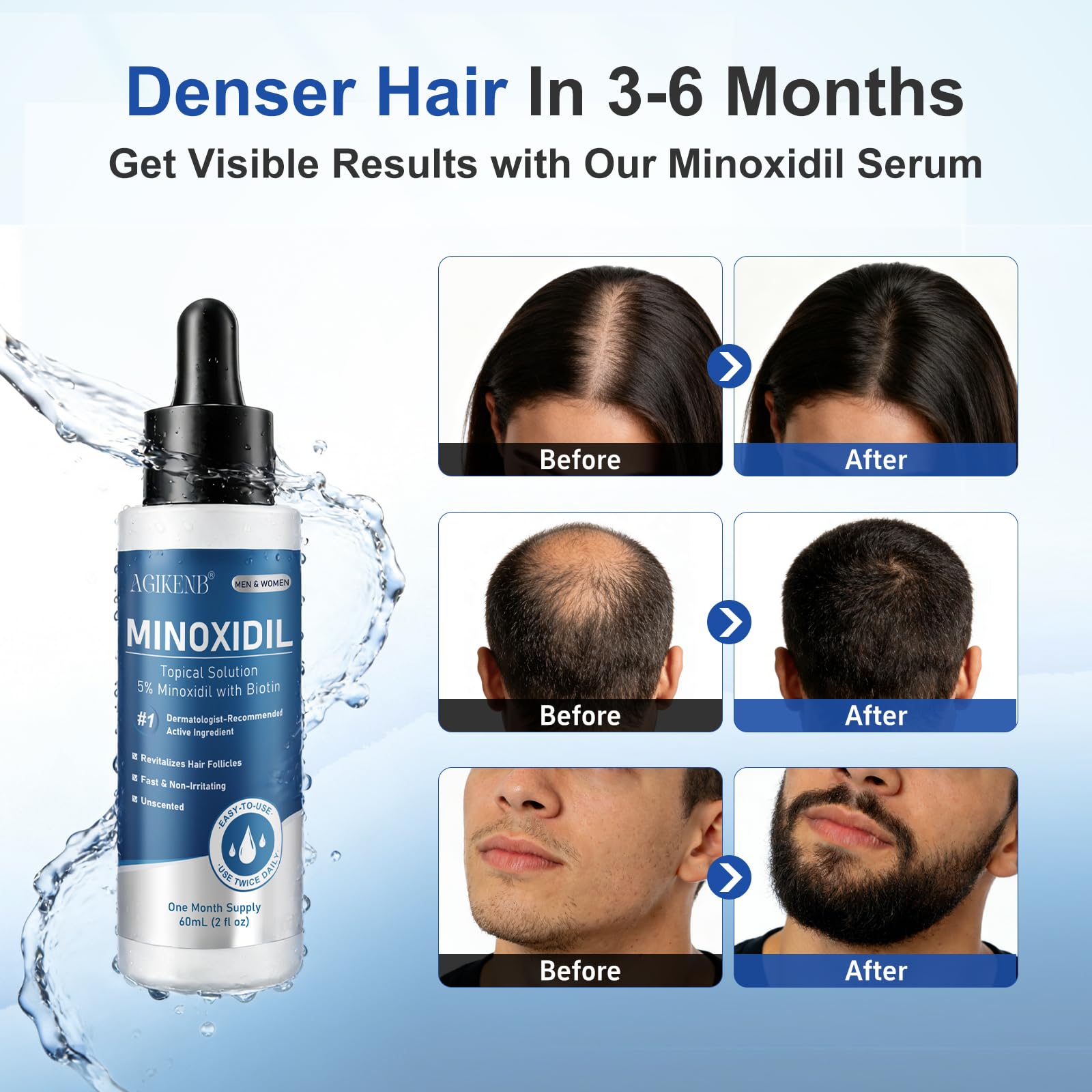 AGIKENB 8 Packs Topical 5% Minoxidil Serum – Hair & Beard Growth Support for Men & Women (Unscented, 8 x 2 fl oz)