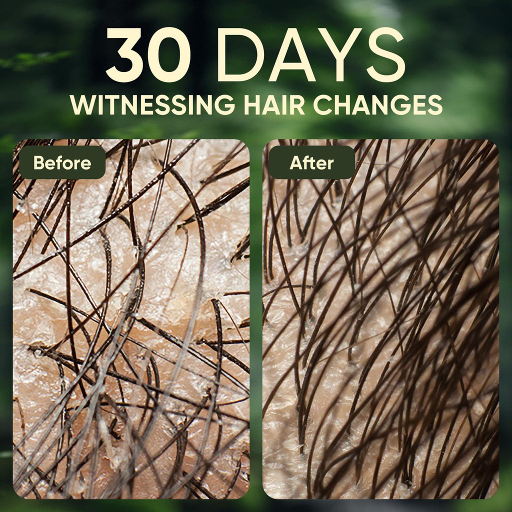 Agodafoo Batana Oil Shampoo & Conditioner Set – Hair Growth Support & Damage Repair (300ml x 2)