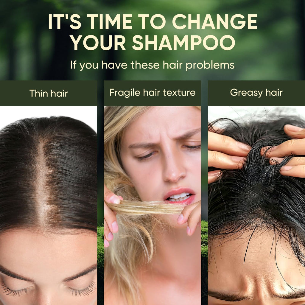 Agodafoo Batana Oil Shampoo & Conditioner Set – Hair Growth Support & Damage Repair (300ml x 2)