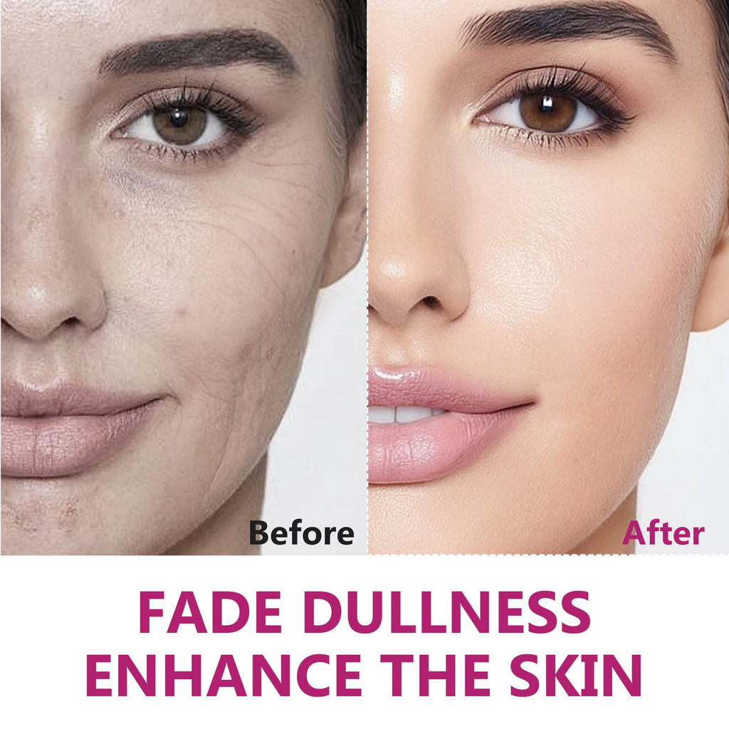 AiRunTech Arbutin 8% + Tranexamic Acid 5% Cream — Fade Dark Spots, Blemishes & Pigmentation, 60ML