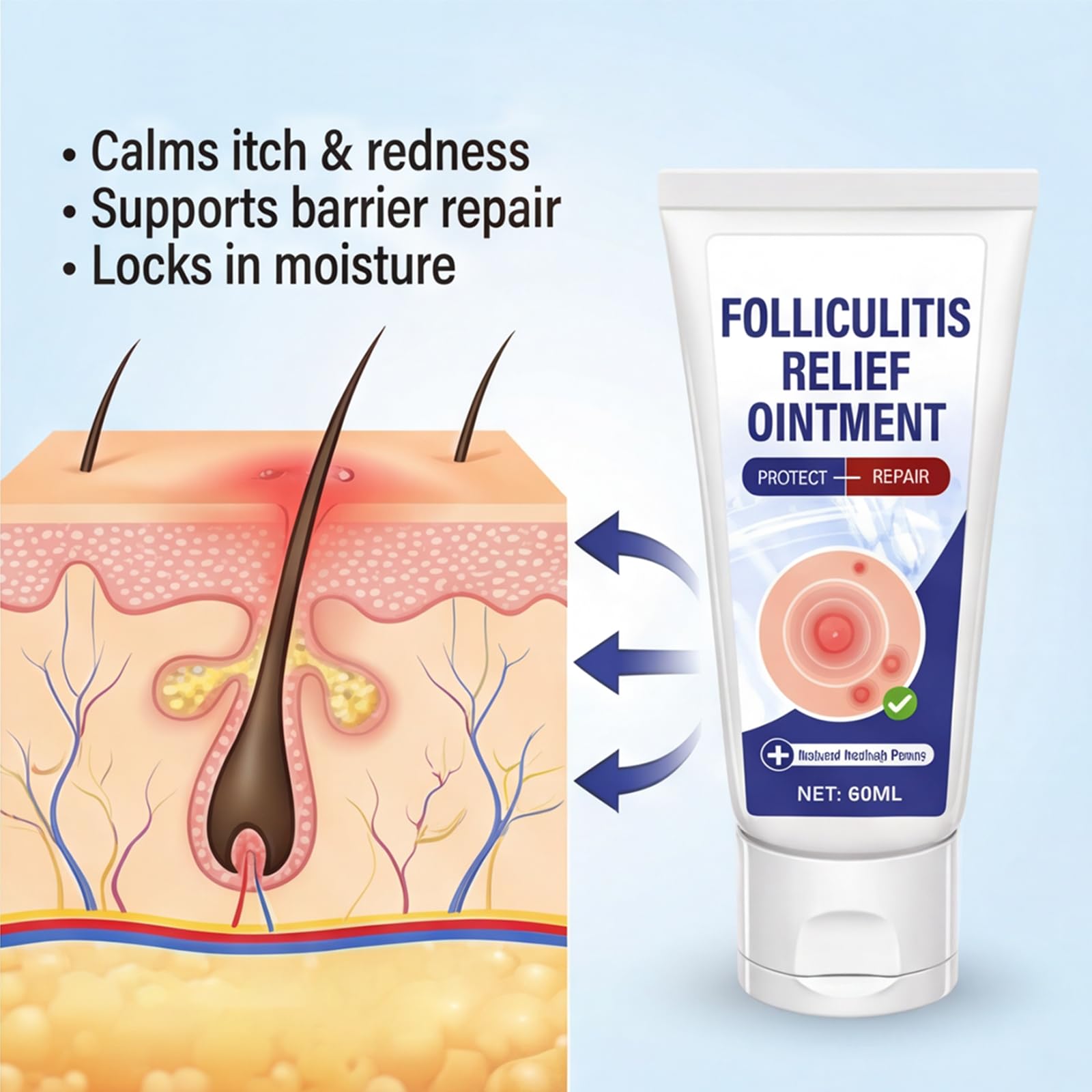 AKQBPN Folliculitis Treatment Cream - Soothes Itching & Redness | Natural, Non-Irritating Formula | 2oz