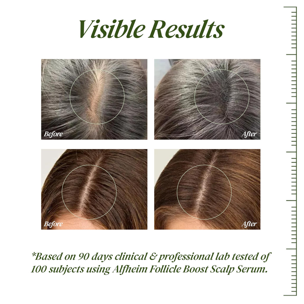 ALFHEIM Saw Palmetto Scalp Serum – Caffeine & Biotin for Thicker Hair | 1.69 fl oz + Serum Applicator