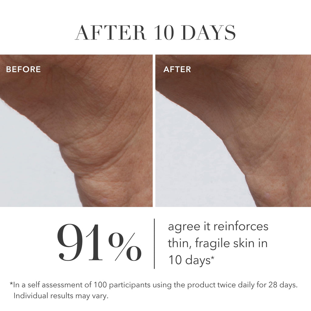 Algenist GENIUS Ultimate Anti-Aging Cream – Restore Elasticity, Smooth Fine Lines